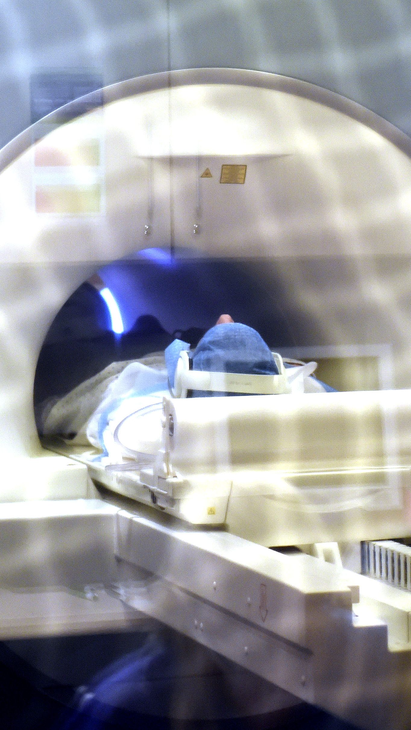 Derzeit muss man auf einen MR-Termin in Wien lange warten.