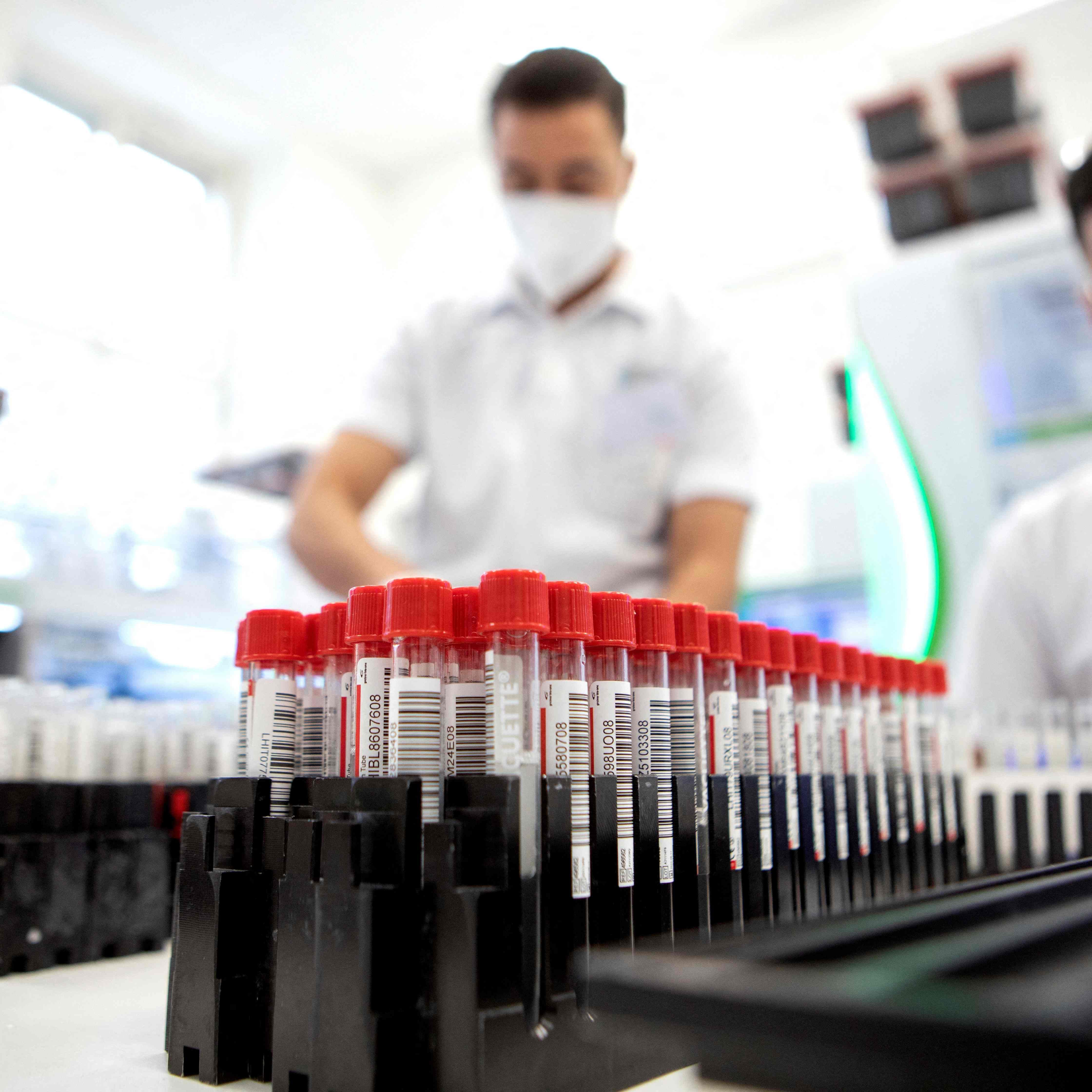 Die Coronazahlen in Österreich gehen weiter nach oben.