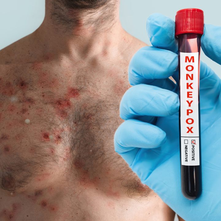 Zuvor Brasilien hatte über einen Todesfall durch das Virus berichtet