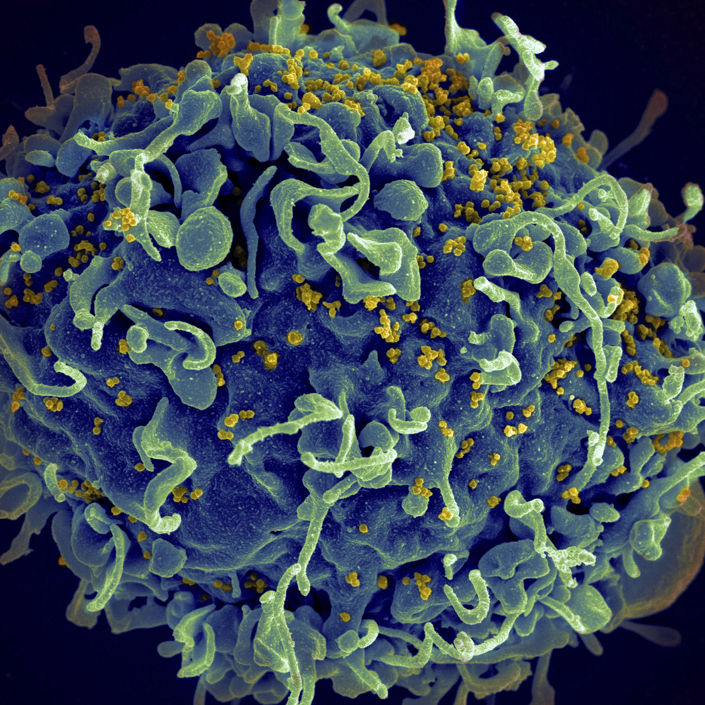 Der Kampf gegen das HIV-Virus stockte unter anderem wegen Corona.
