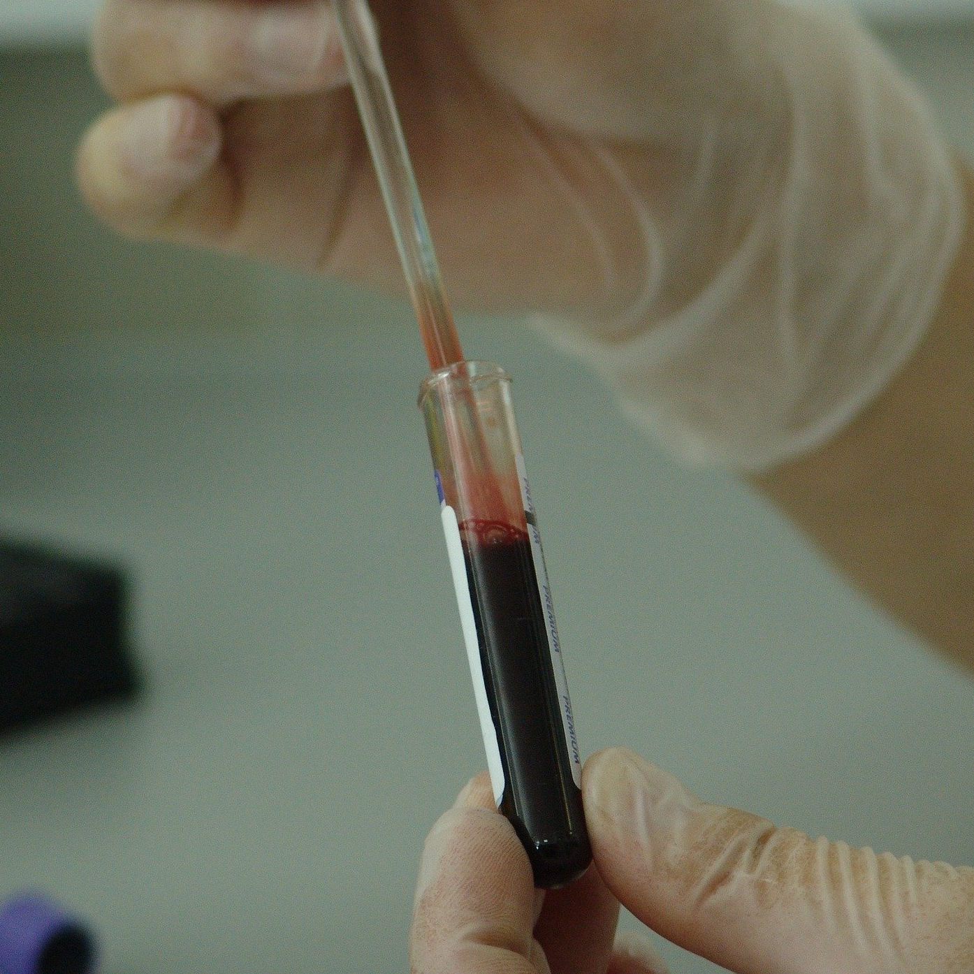 Wien bekommt ein neues Krebsforschungsgebäude.