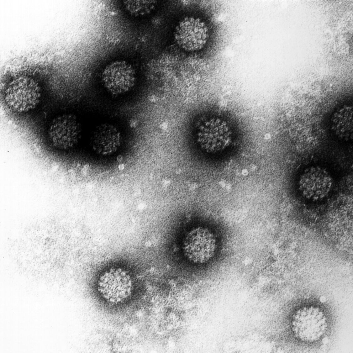 Ein neuer Test von Forscher der Uni Innsbruck soll bei der zuverlässigen Früherkennung von Gebärmutterkrebs helfen.