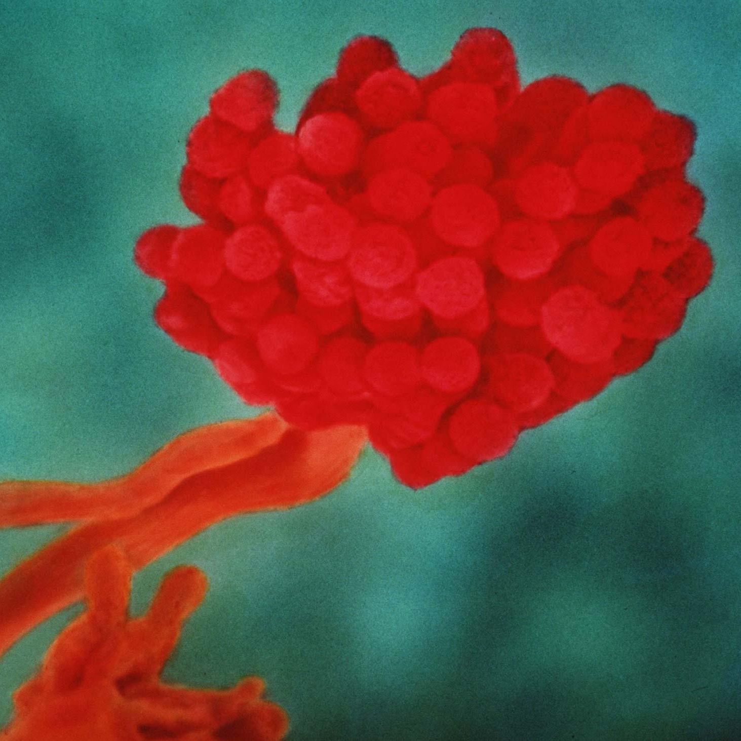 Eine internationale Studie untersuchte den Zusammenhang zwischen Corona- und Pilzinfektionen.