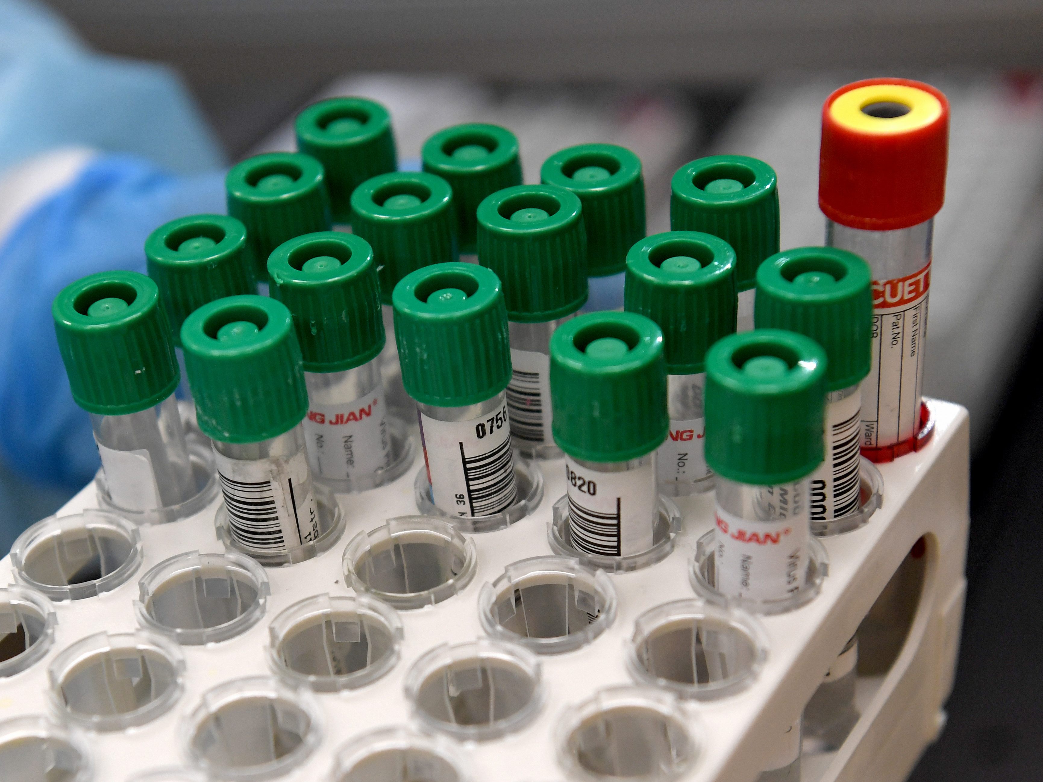 3.831 Neuinfektionen mit dem Coronavirus wurden am Sonntag in Österreich gemeldet.