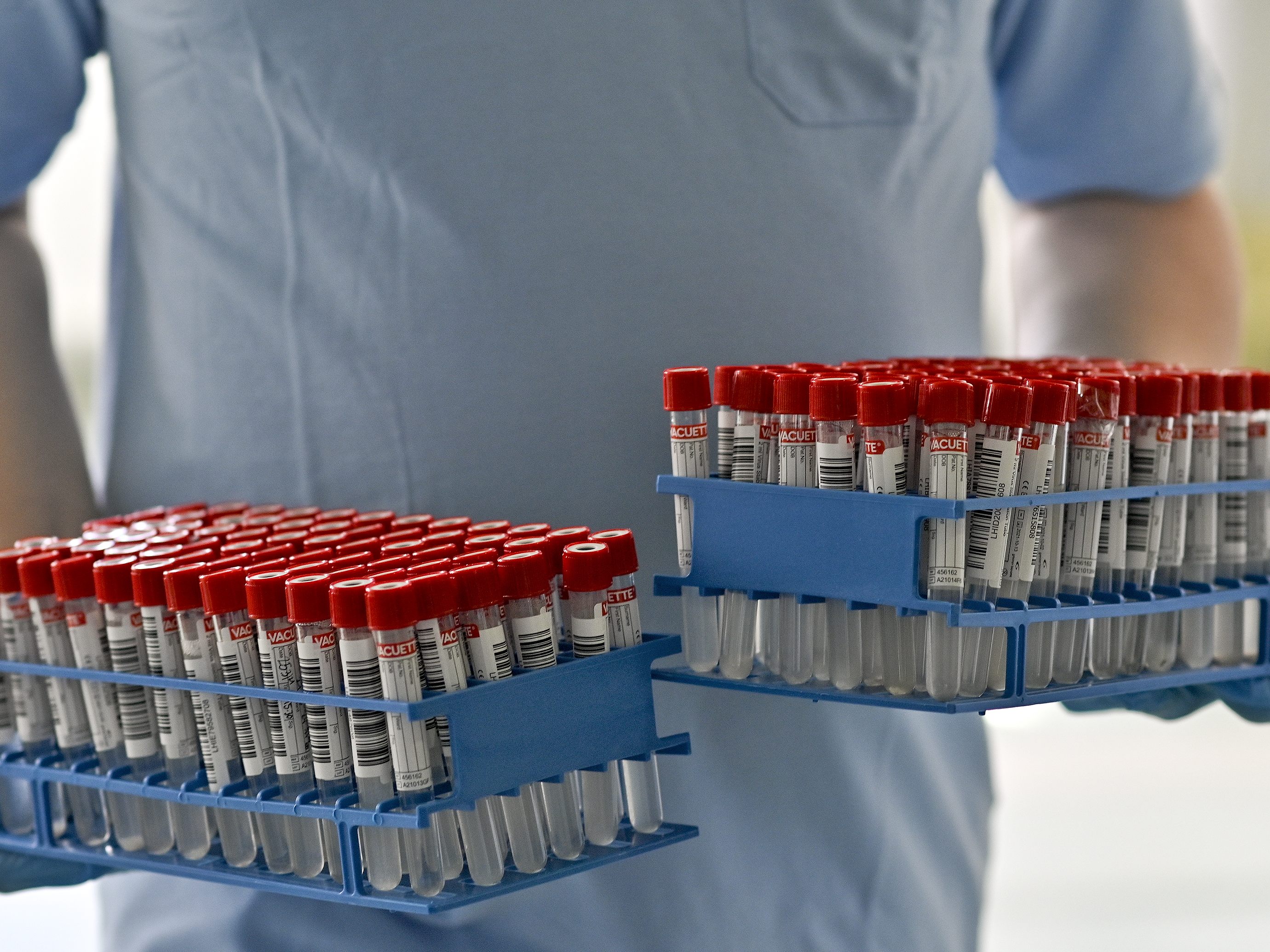 Am Dienstag wurden 4.654 Corona-Neuinfektionen in Österreich gemeldet.