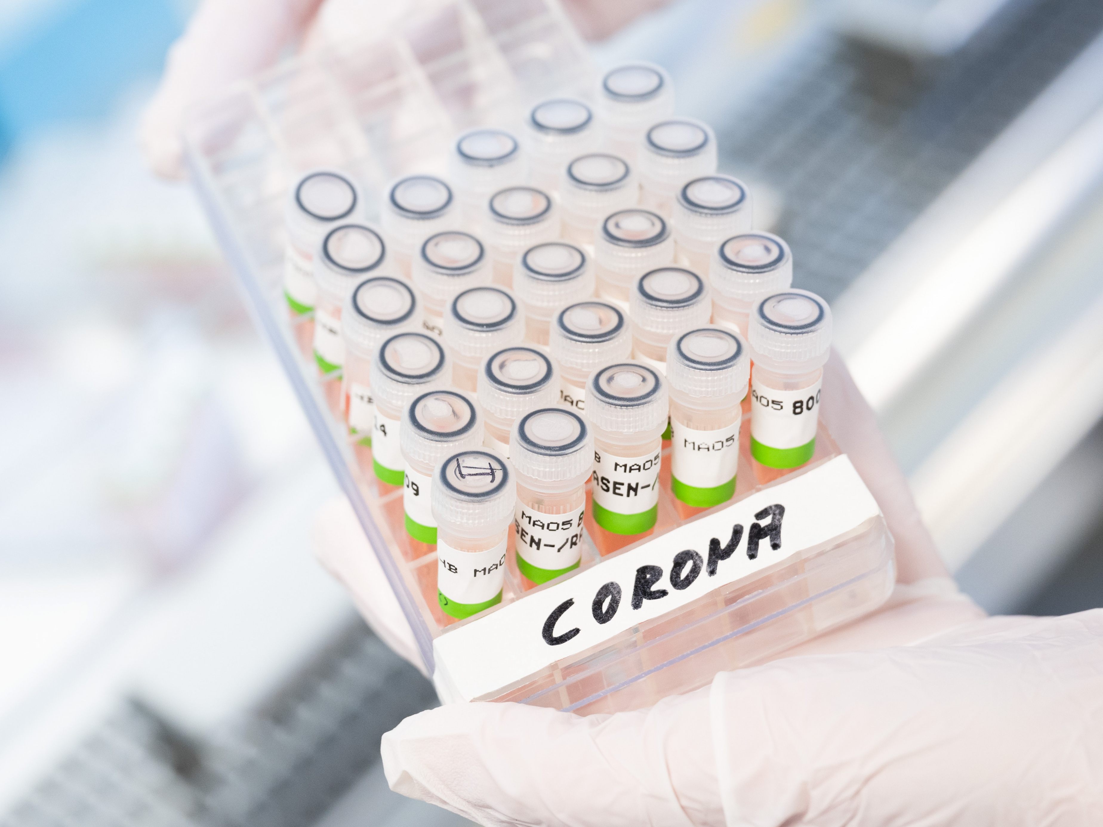 Eine bestimmte Genvariante verringert das Sterberisiko bei Corona. Eine bestimmte Genvariante verringert das Sterberisiko bei Corona.