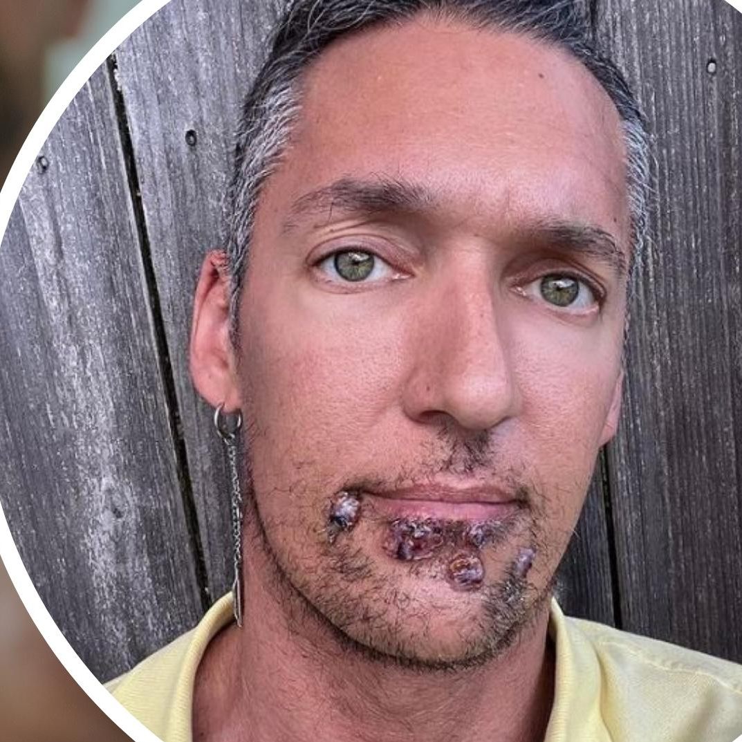 Silver Steele möchte mit seinen Posts anderen Betroffenen helfen.