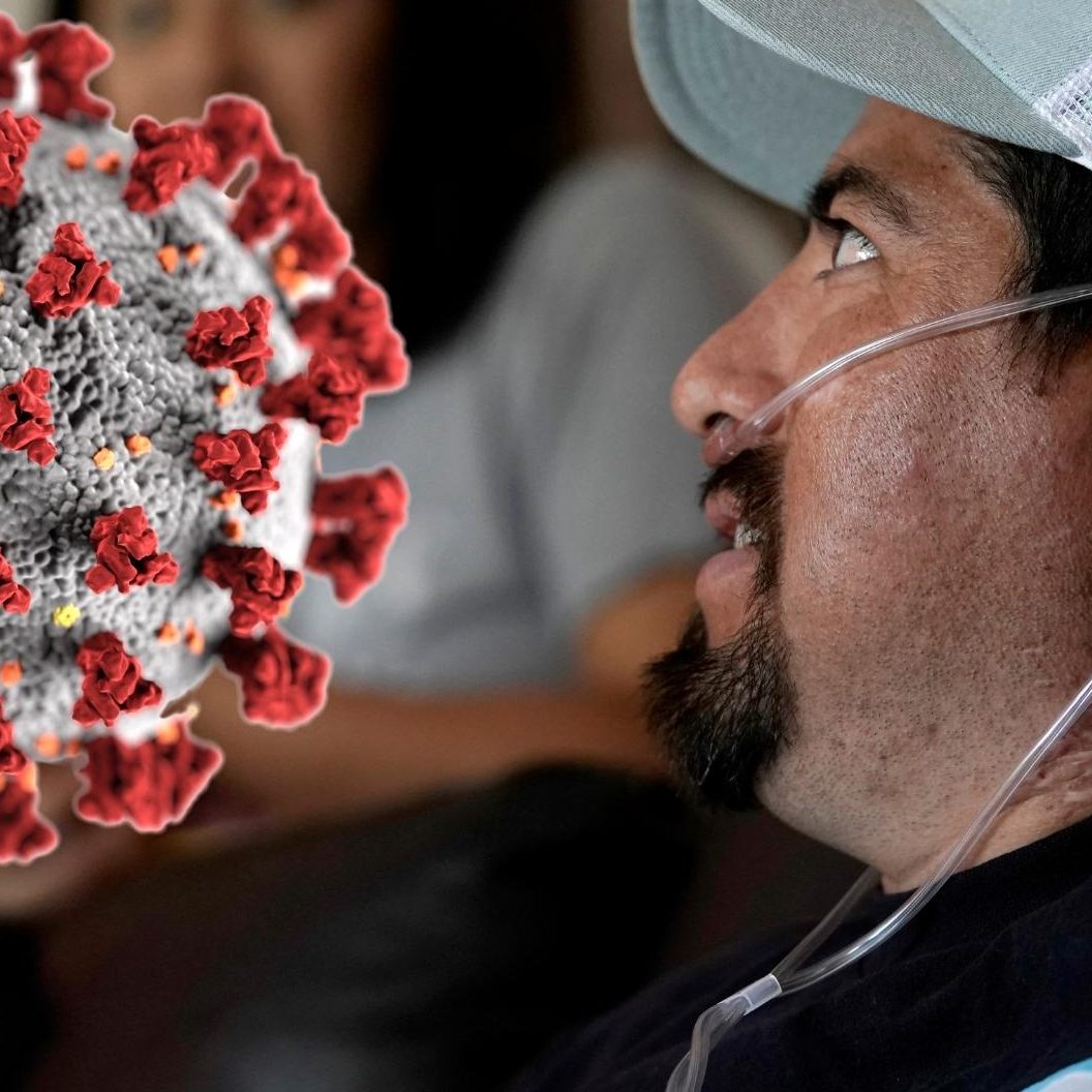 Forscher befragten Zehntausende Infizierte und Nicht-Infizierte bezüglich Long Covid.