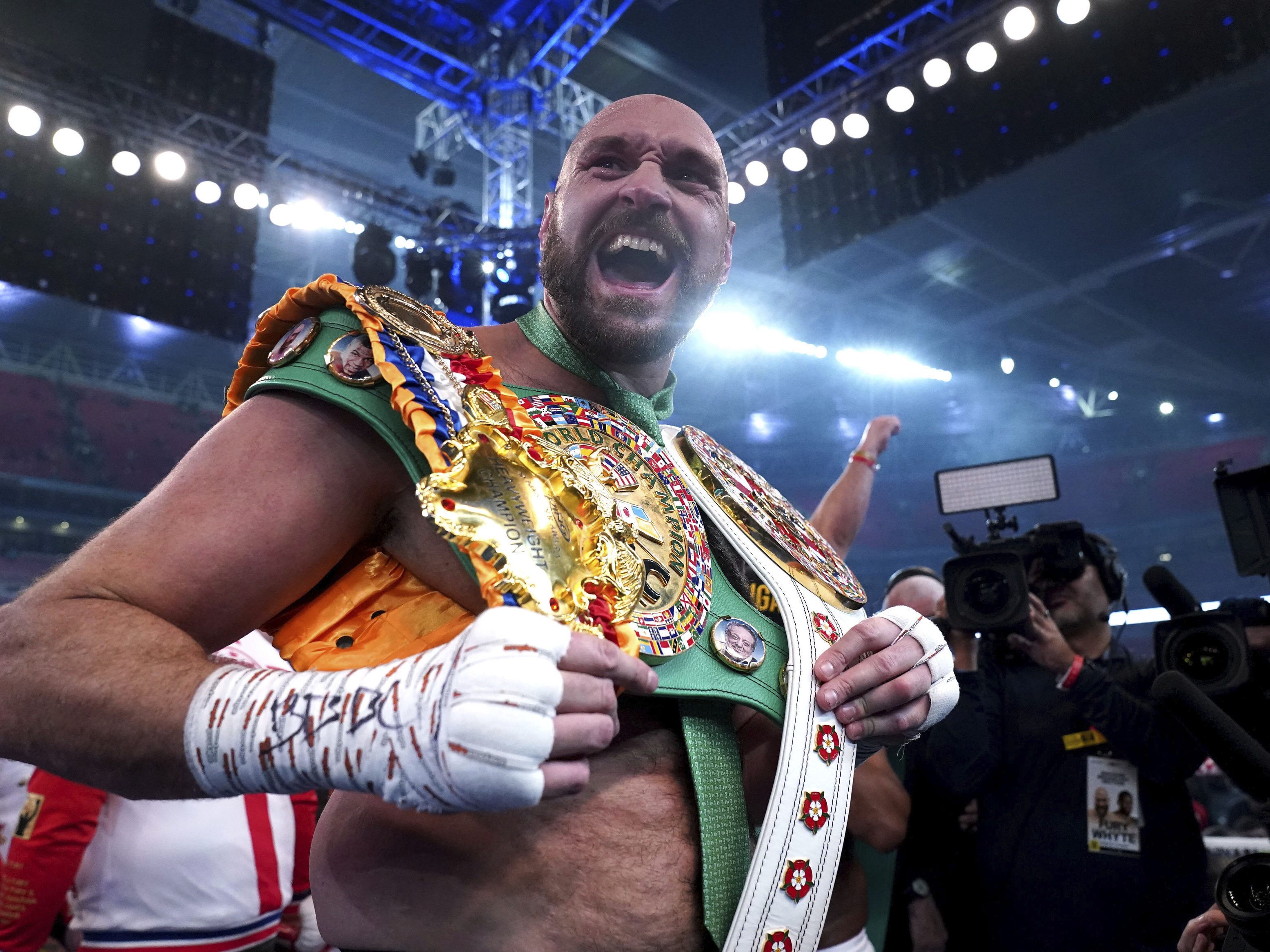 Tyson Fury.