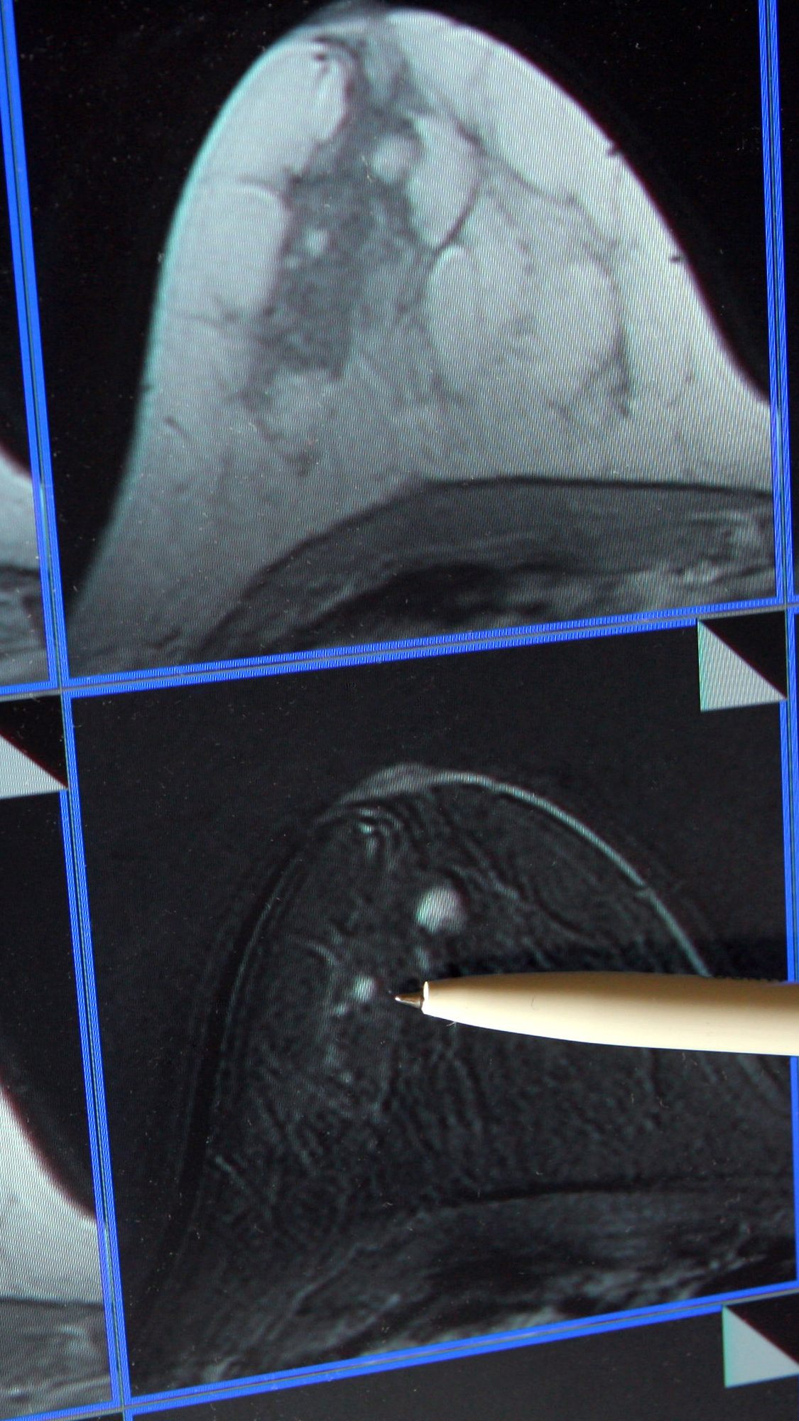 40 Prozent der Frauen halten den Intervall zur Früherkennung nicht ein.
