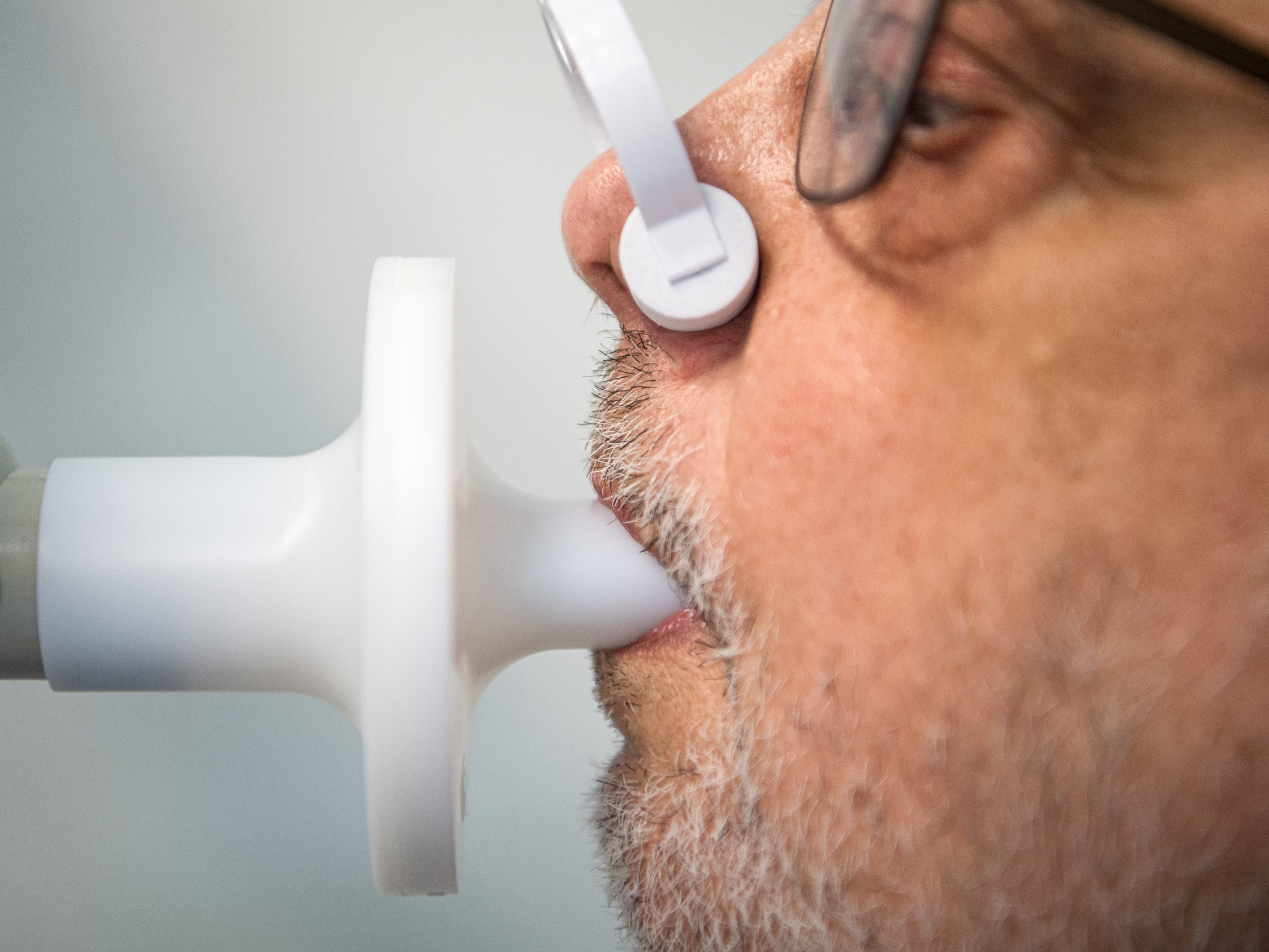 17 Millionen Menschen in Europa hatten laut der WHO mit Long-Covid-Symptomen zu kämpfen.