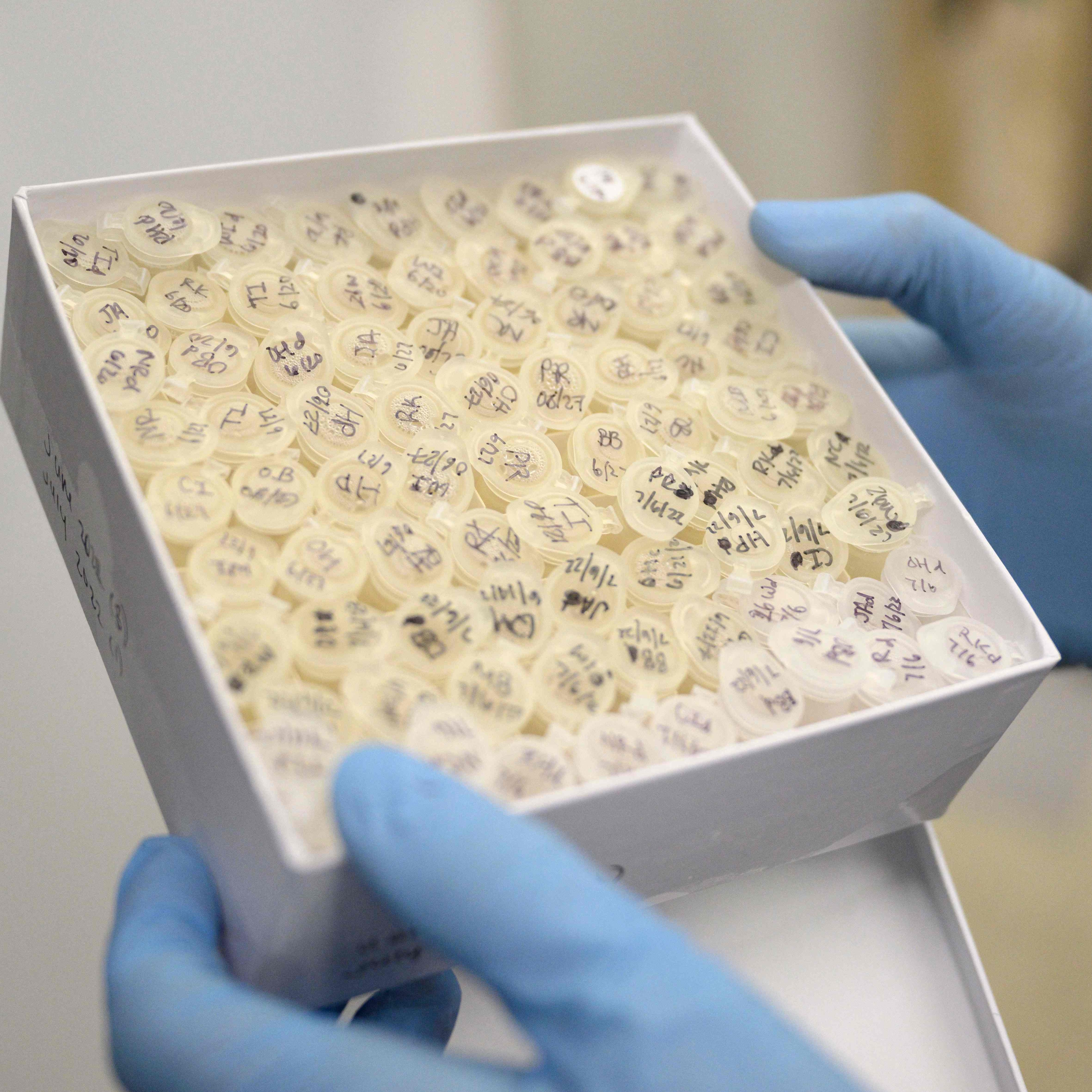 In New York wurden Polioviren im Abwasser nachgewiesen.