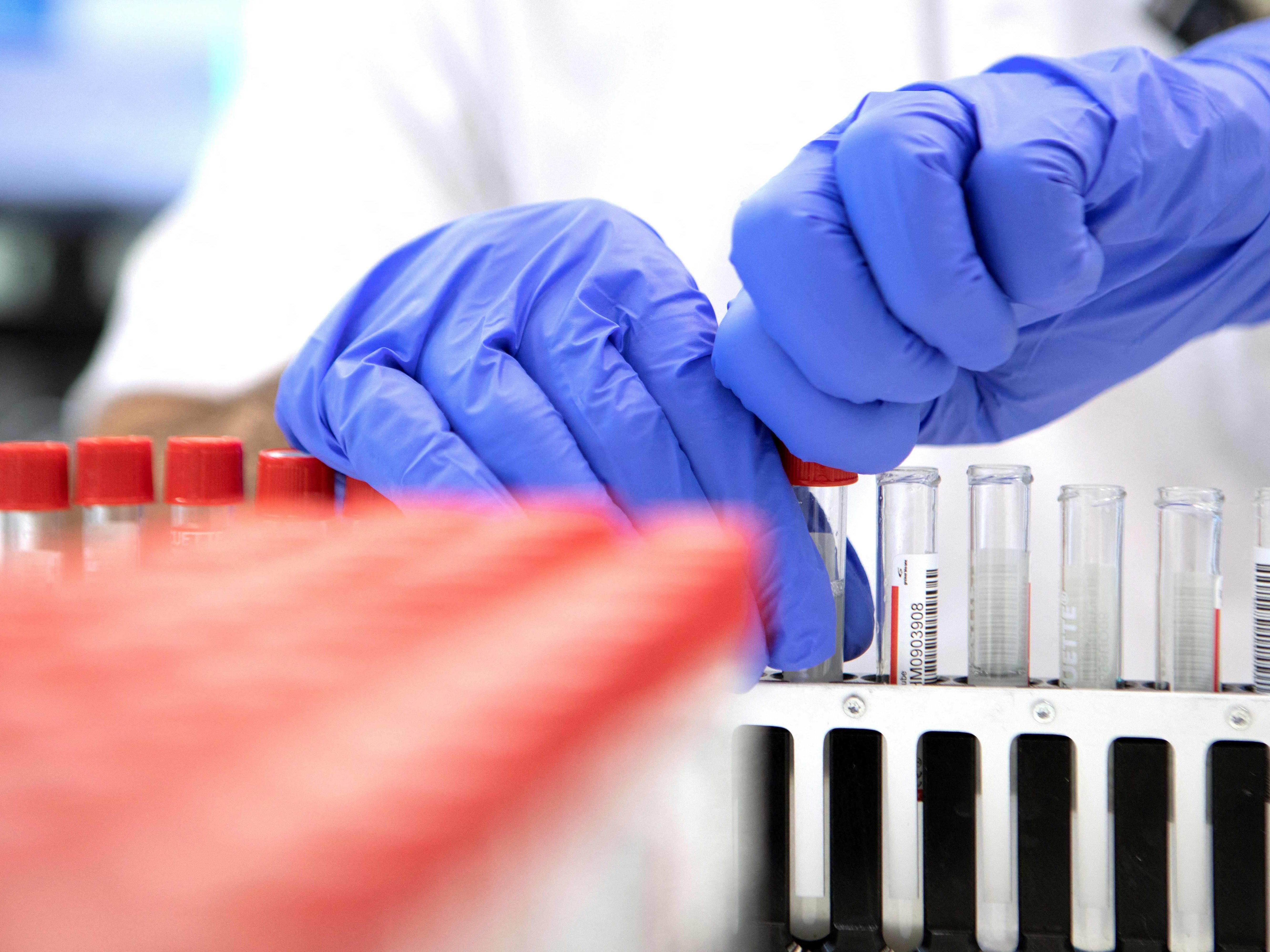 Laut Corona-Prognose steigt die Zahl der Corona-Infizierten in den Spitälern bis Oktober wieder an.