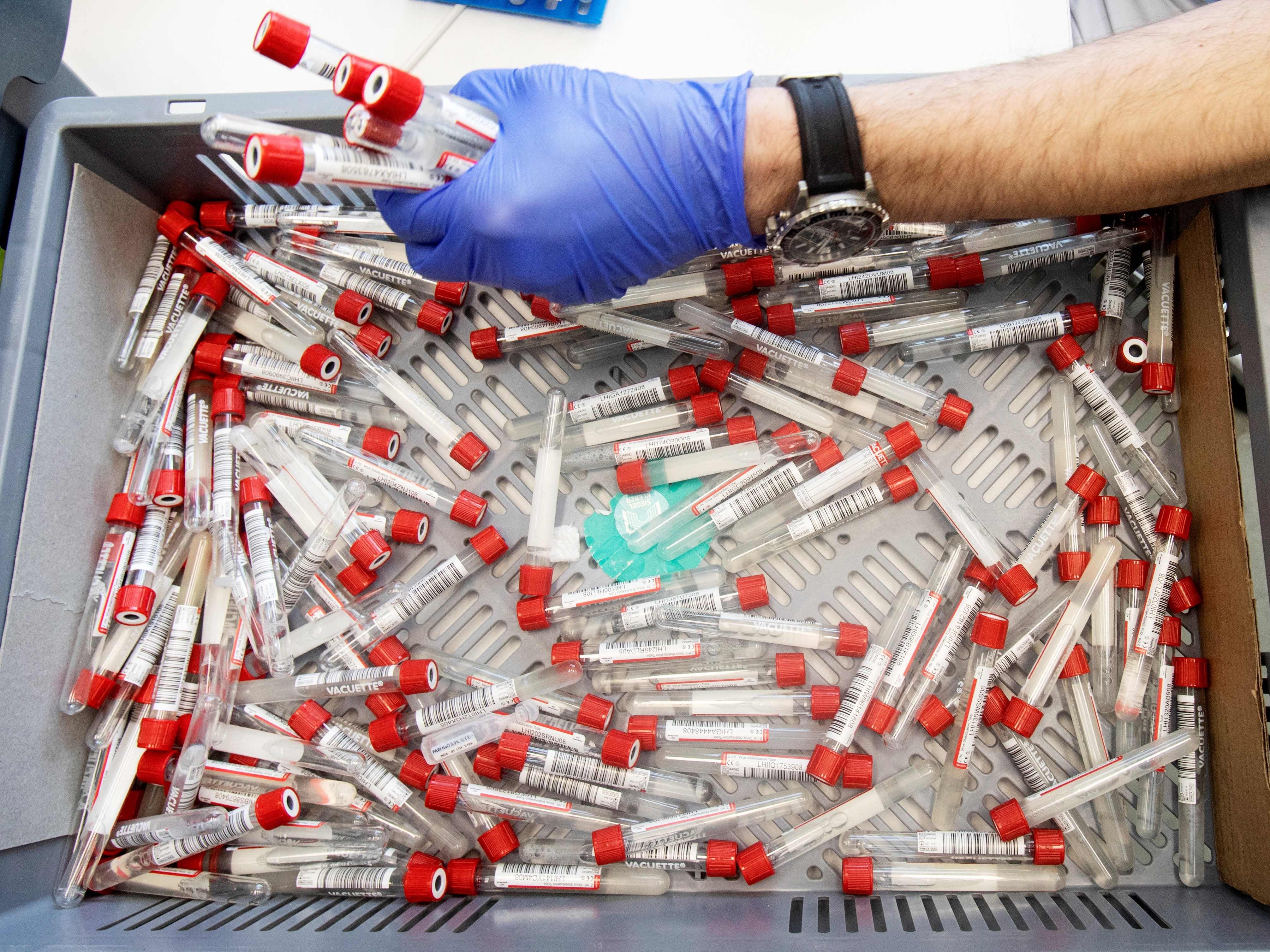 2.574 Corona-Neuinfektionen wurden am Montag in Österreich gemeldet.