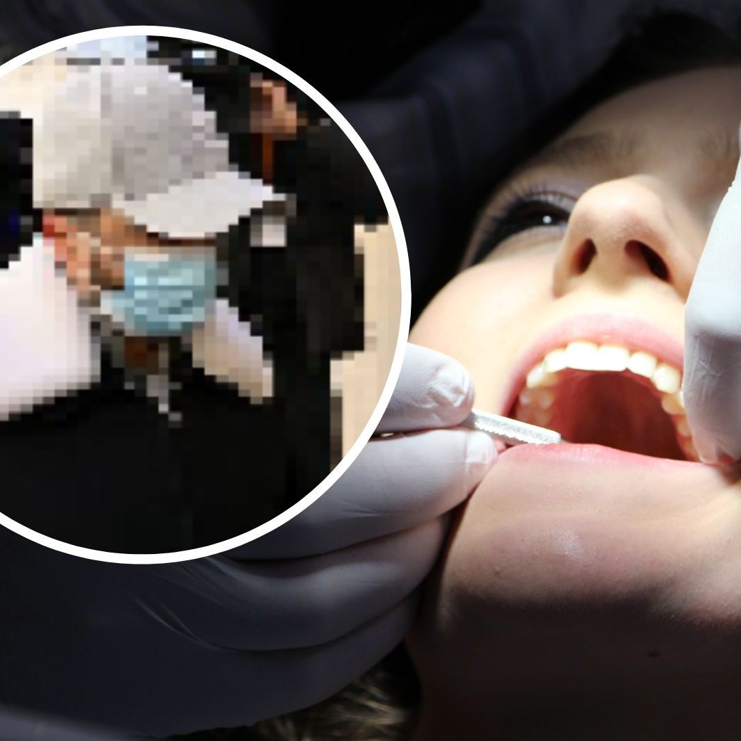 Dem Zahnarzt Lionel Guedj wird vorgeworfen, er habe etwa 4.000 gesunde Zähne gezogen.