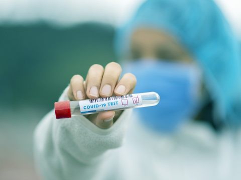 Am Sonntag wurden in Österreich 3.420 Corona-Neuinfektionen gemeldet.