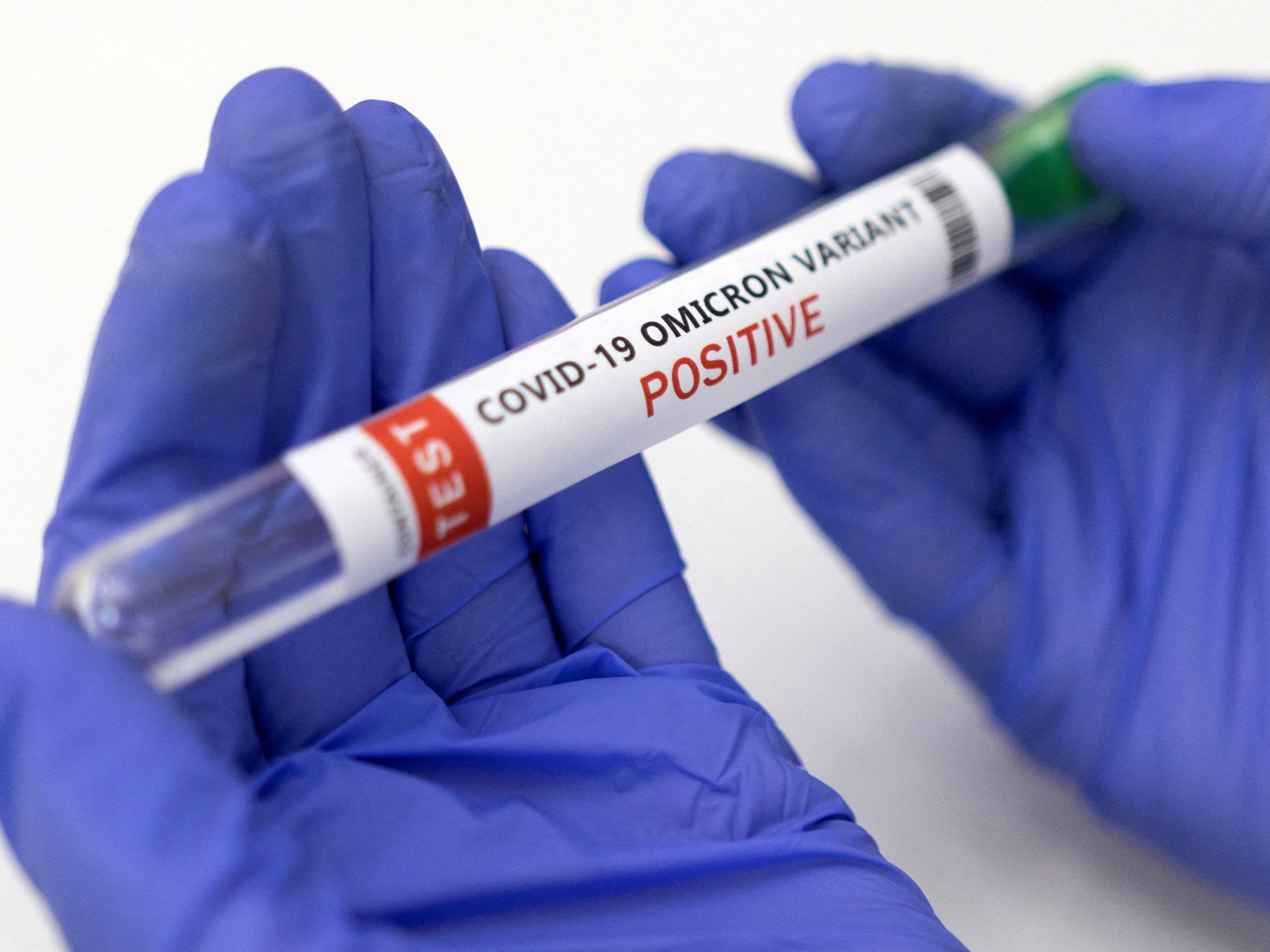 7.151 Coronavirus-Neuinfektionen am Samstag in Österreich gemeldet. 7.151 Coronavirus-Neuinfektionen am Samstag in Österreich gemeldet.