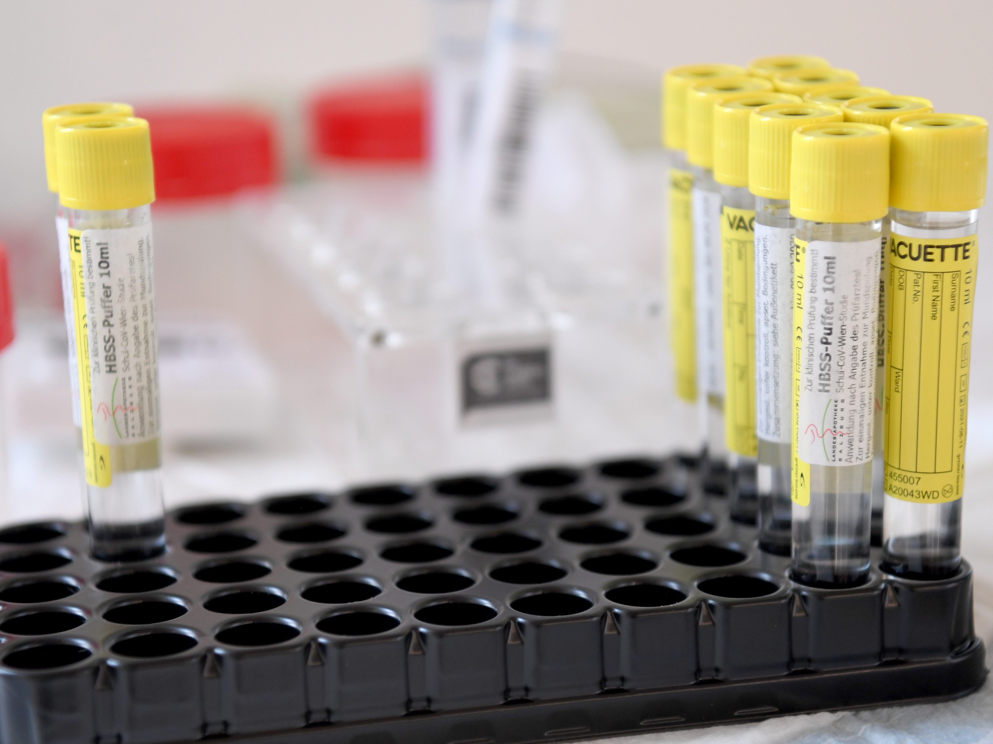 PCR-Testsystem für Schulen bald wieder auf Schiene. PCR-Testsystem für Schulen bald wieder auf Schiene.