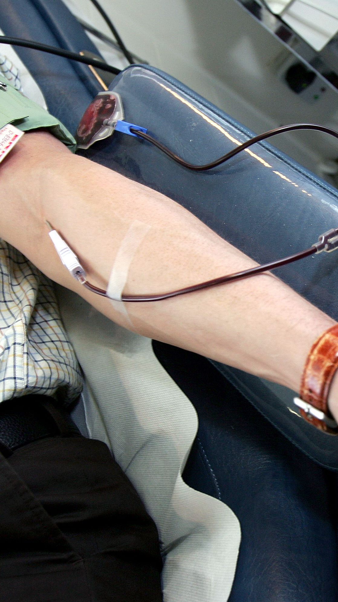 Wegen der fehlenden Blutplasmaspenden in Österreich steht die medizinische Versorgung derzeit unter Druck.