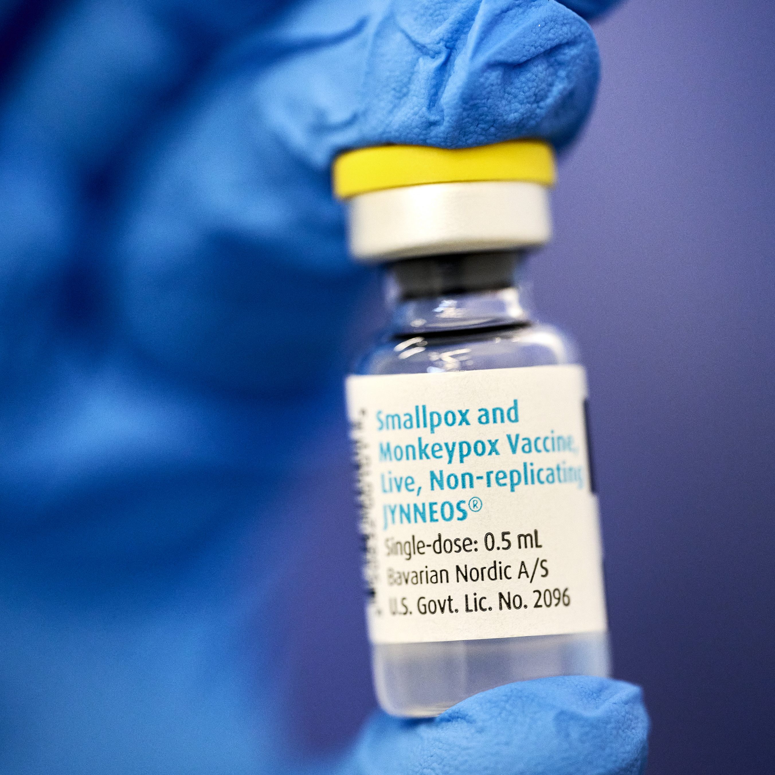 1.500 Impfwillige in Wien benötigen noch Impftermine gegen Affenpocken.