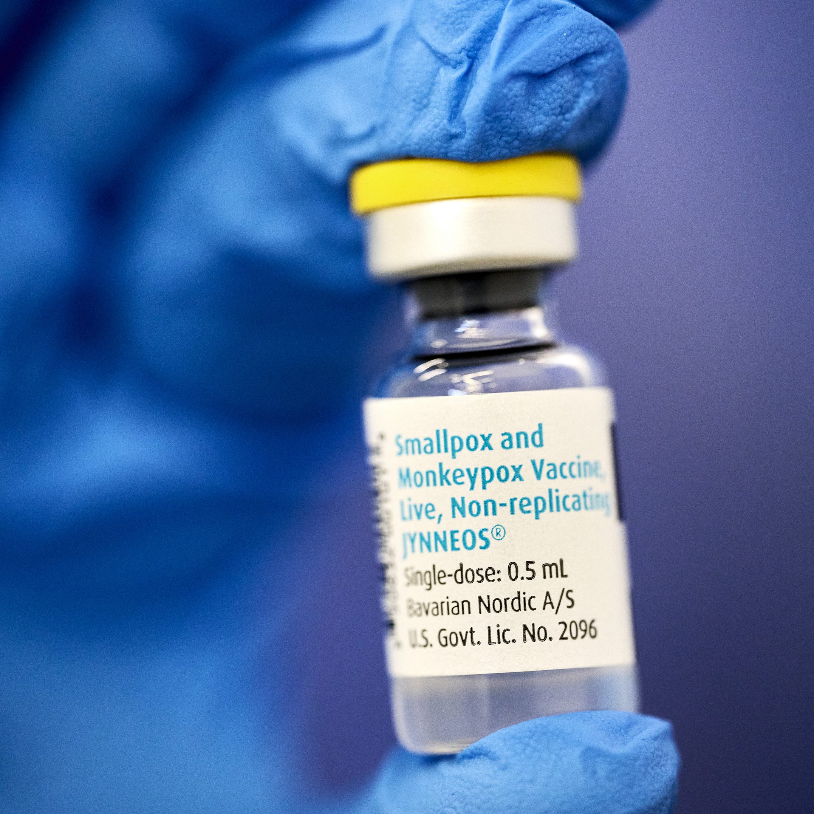 Affenpocken - Wien schaltet weitere 1.200 Impftermine frei.