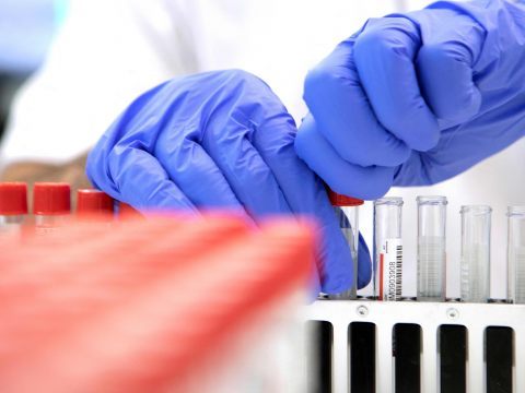 Am Samstag wurden mehr als 12.000 Corona-Neuinfektionen gemeldet.