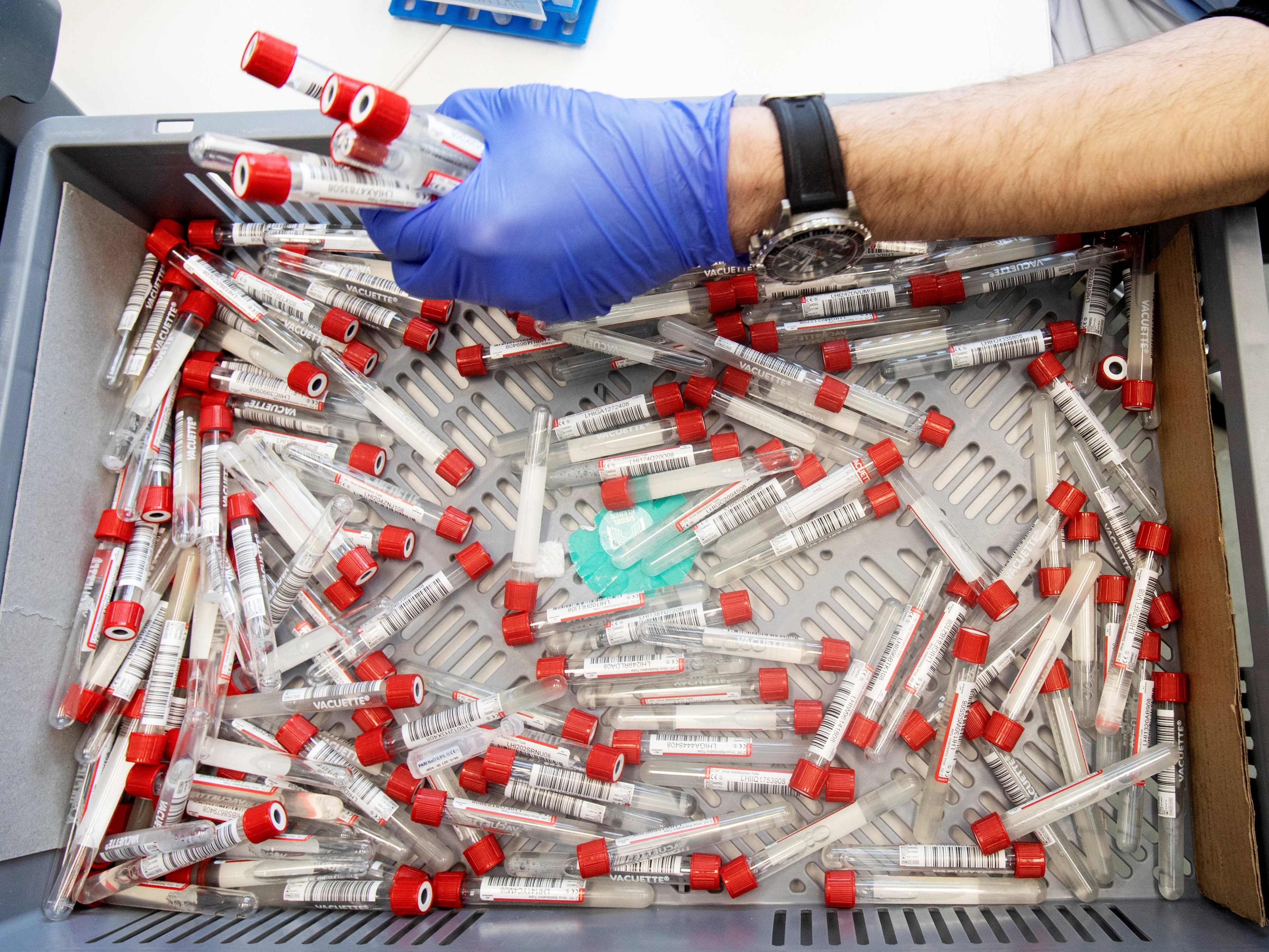 In Österreich gab es am Dienstag um zehn Prozent mehr Corona-Patienten in Spitälern als noch am Montag.