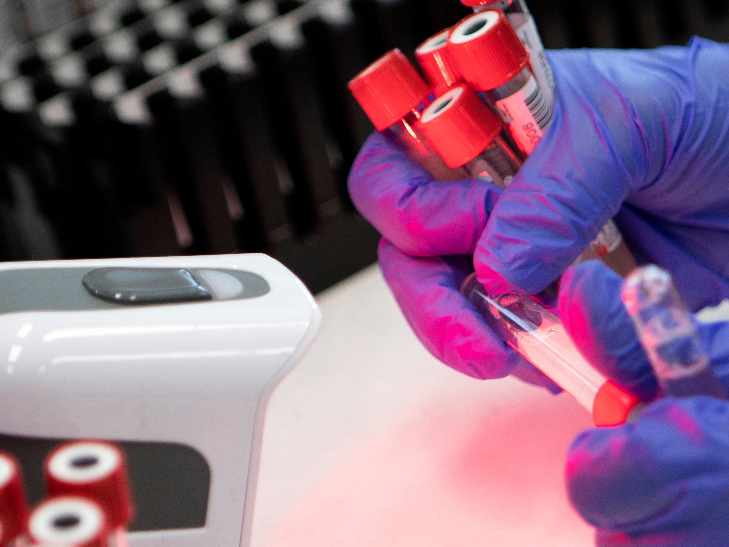 8.080 Corona-Neuinfektionen wurden in Österreich am Montag gemeldet.