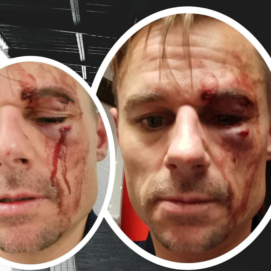 Weil er Zivilcourage zeigte, wurde Nicolas F. aus Feldkirch brutal zusammengeschlagen.