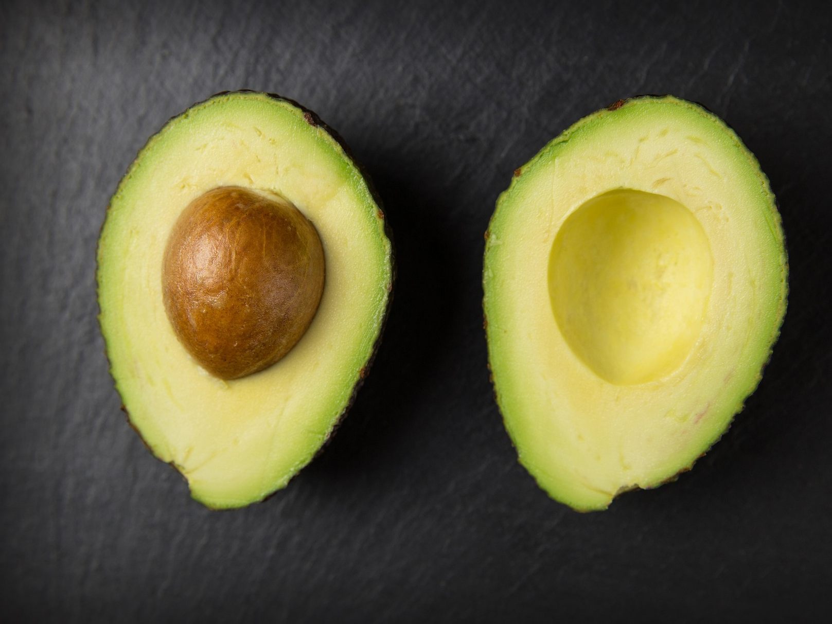 Wie gesund sind Avocados? Wie gesund sind Avocados?