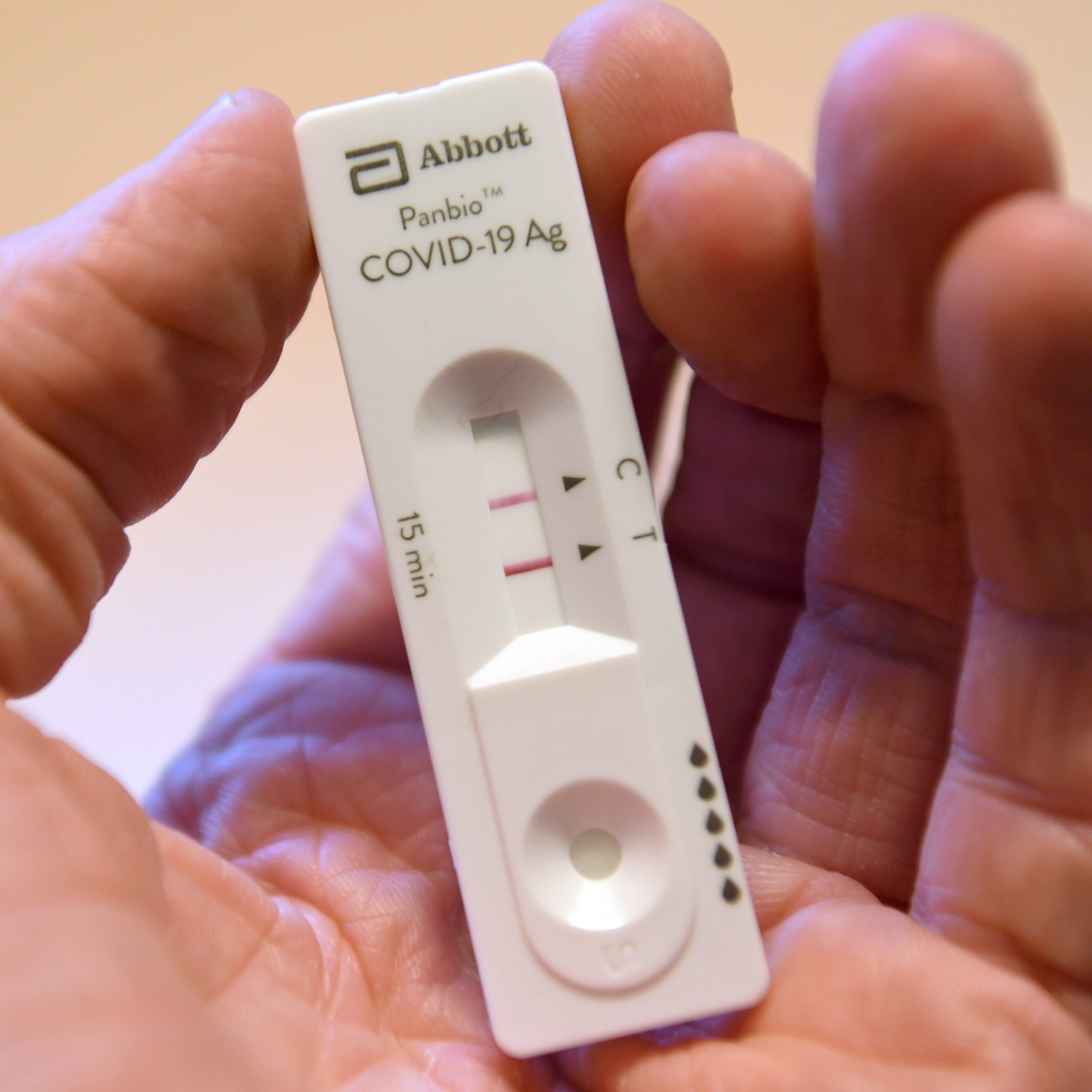 Eine Corona-Erkrankung kann die Blut-Hirn-Schranke beeinträchtigen.