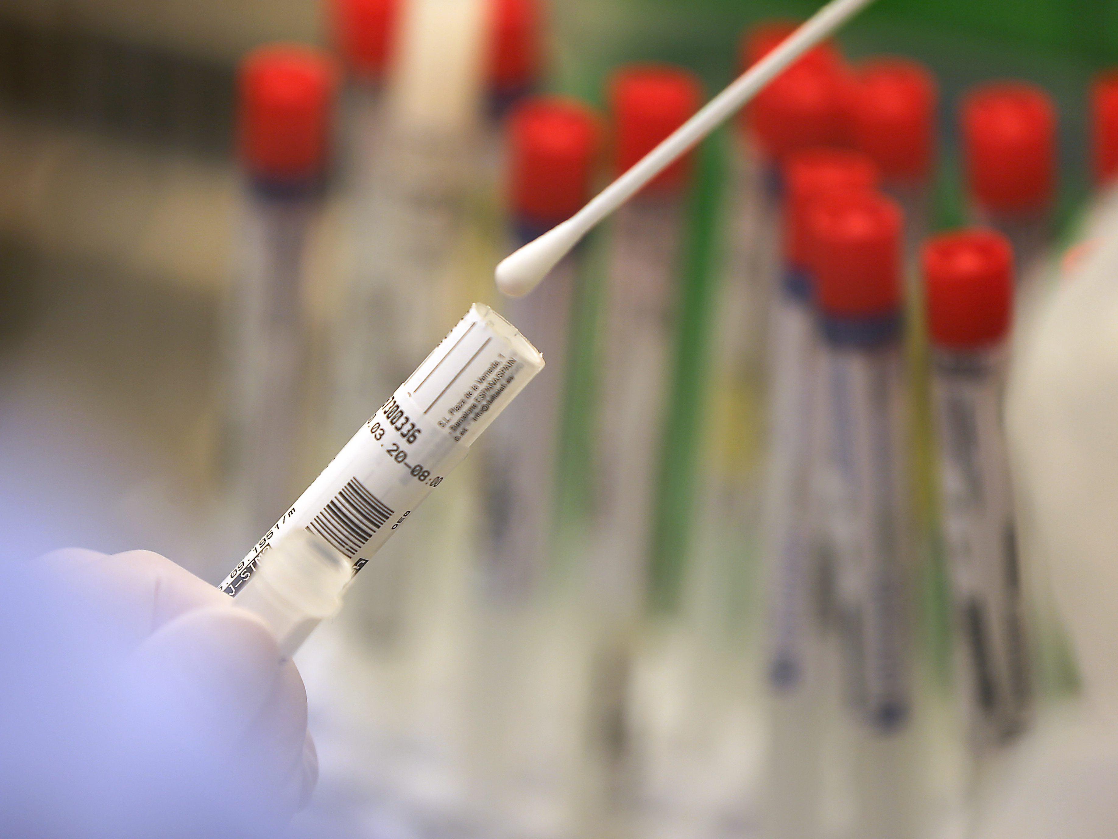 5.826 Coronavirus-Neuinfektionen am Freitag in Österreich gemeldet. 5.826 Coronavirus-Neuinfektionen am Freitag in Österreich gemeldet.