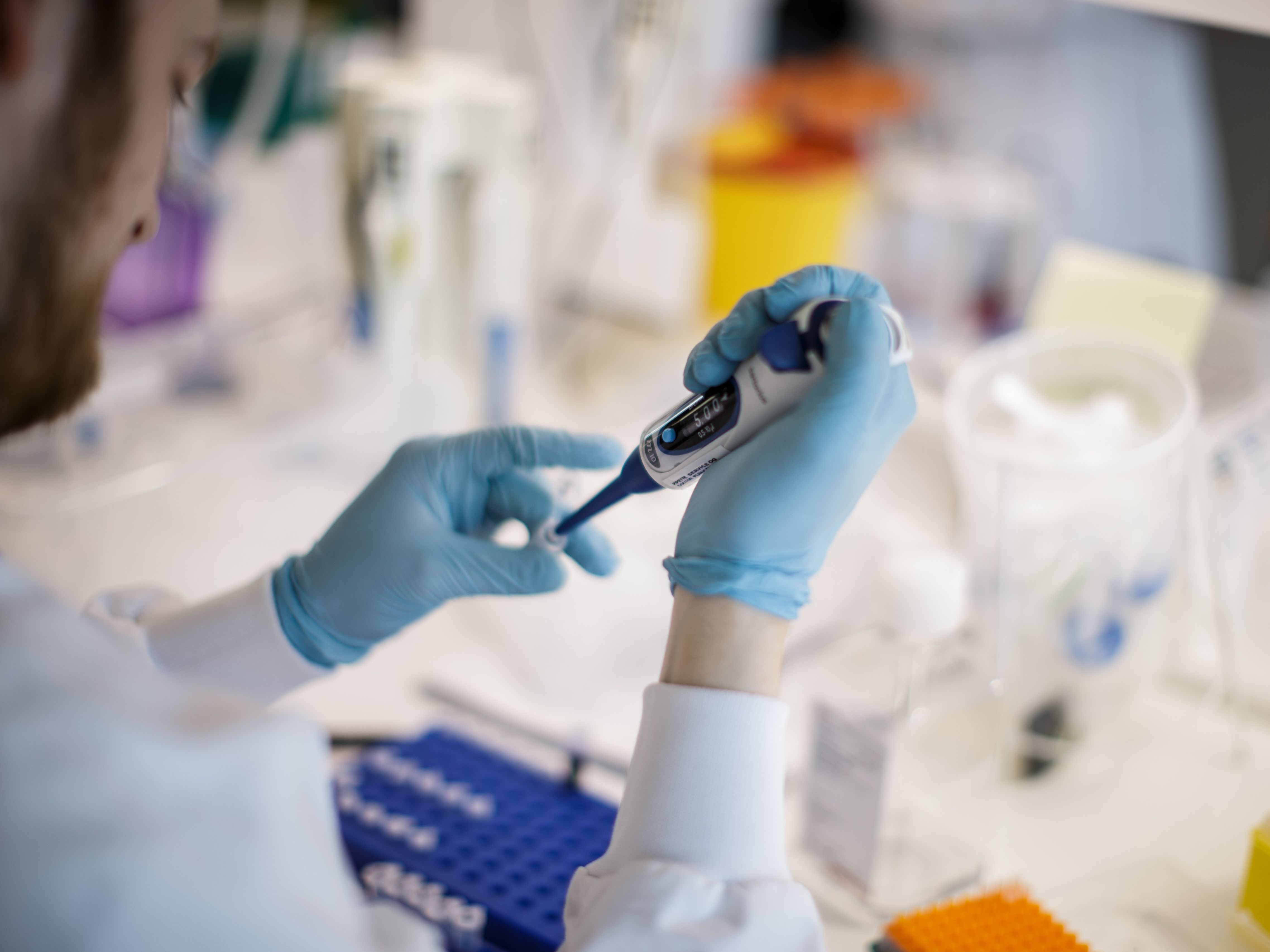 Forscher hoffen, dass ein Bananenprotein Universalmittel gegen Coronaviren sein könnte. Forscher hoffen, dass ein Bananenprotein Universalmittel gegen Coronaviren sein könnte.