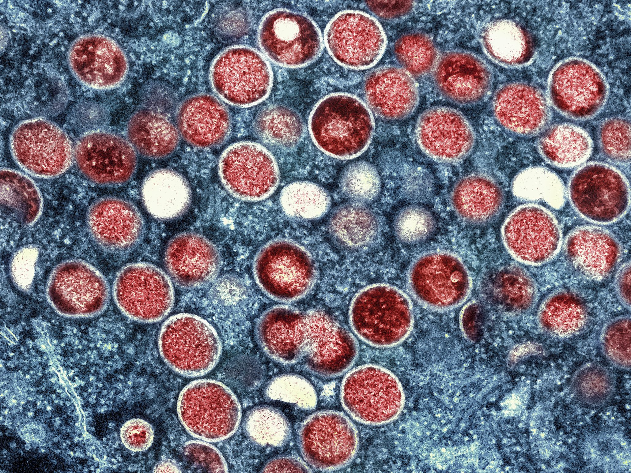 Die WHO nutzt nun Bezeichnung Mpox statt Monkeypox. Die WHO nutzt nun Bezeichnung Mpox statt Monkeypox.