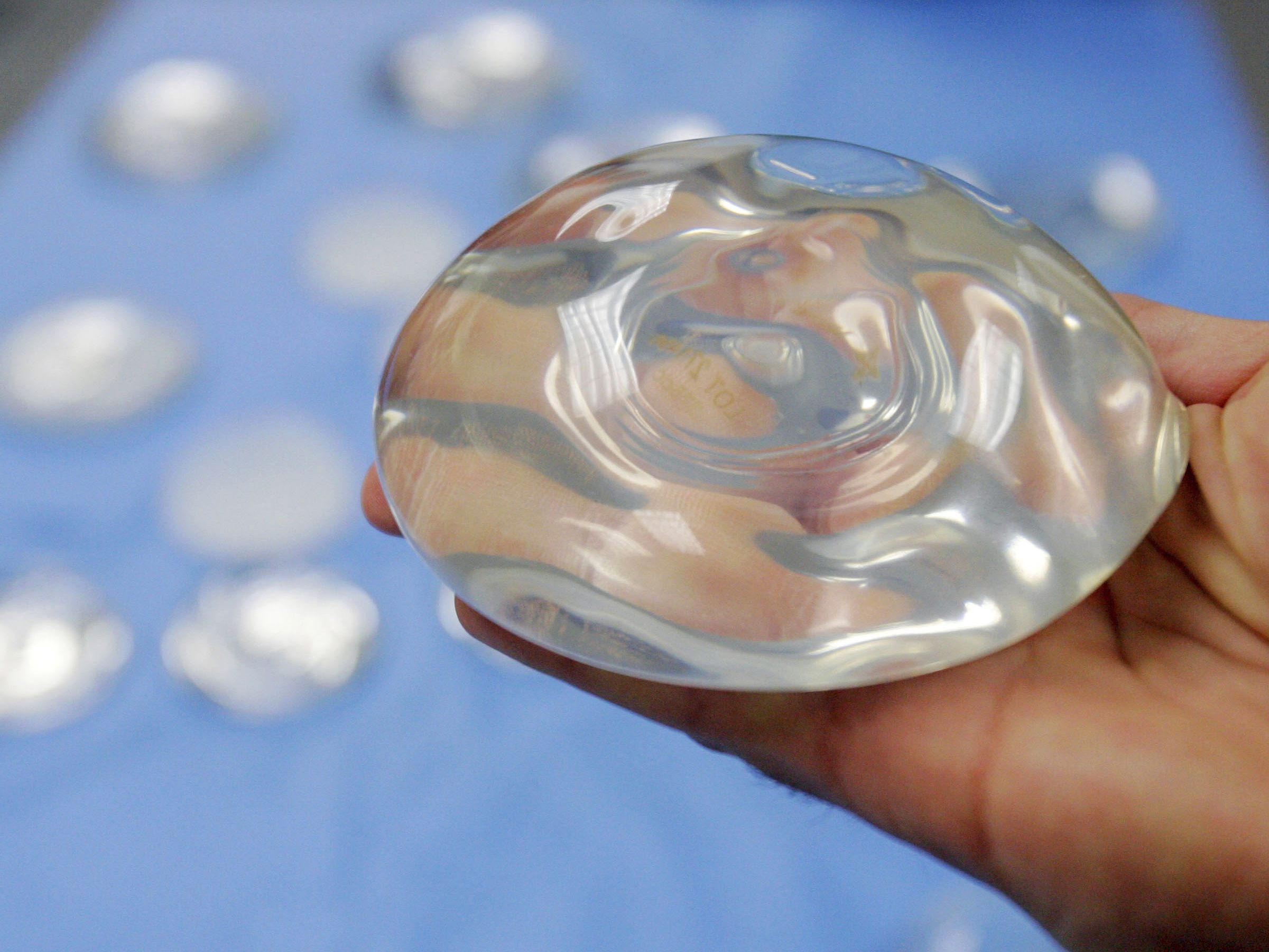 Künftig sollen Ärzte ihre Patienten über Gefahren bei Implantaten aufklären.