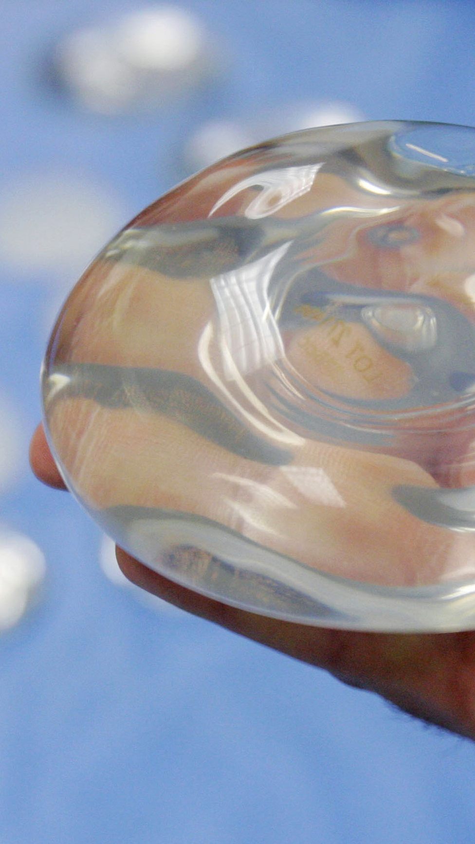 Künftig sollen Ärzte ihre Patienten über Gefahren bei Implantaten aufklären.