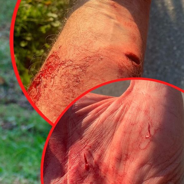 Klaus: Nach über zehn angezeigten Hundeattacken spricht nun ein Opfer für den Kampf mit dem Tier.