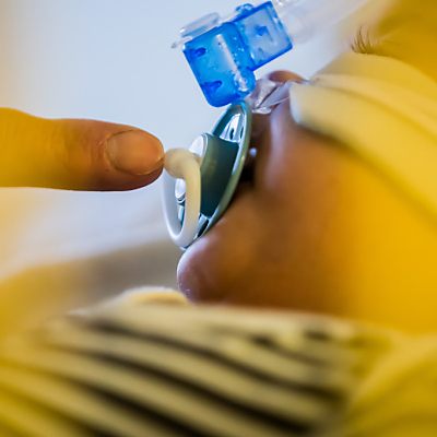 Auch Kinder ohne Impfung von schweren Verläufen betroffen