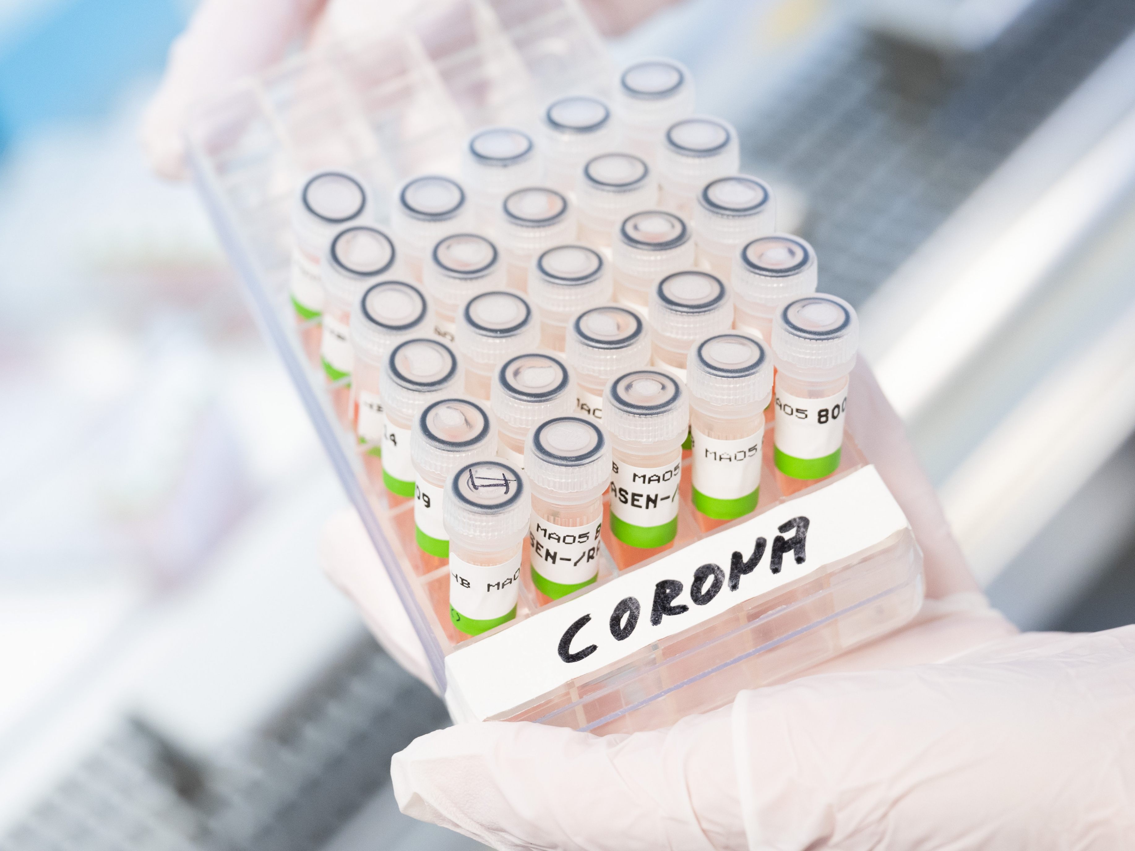 Das Prognosekonsortium geht von einem weiteren Corona-Rückgang auf den Normalstationen aus. Das Prognosekonsortium geht von einem weiteren Corona-Rückgang auf den Normalstationen aus.