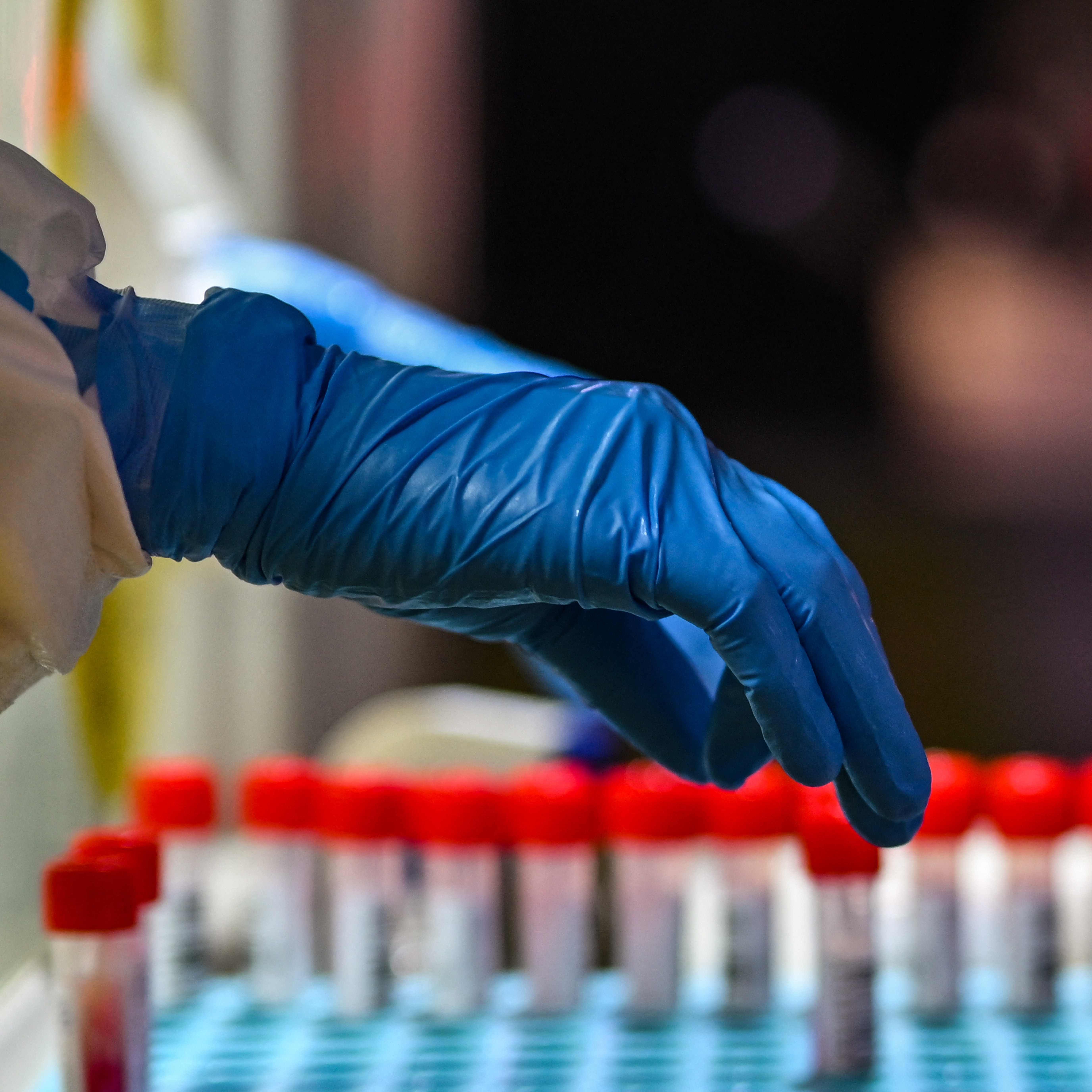 Lediglich 24 Neuinfektionen gab es am Freitag.