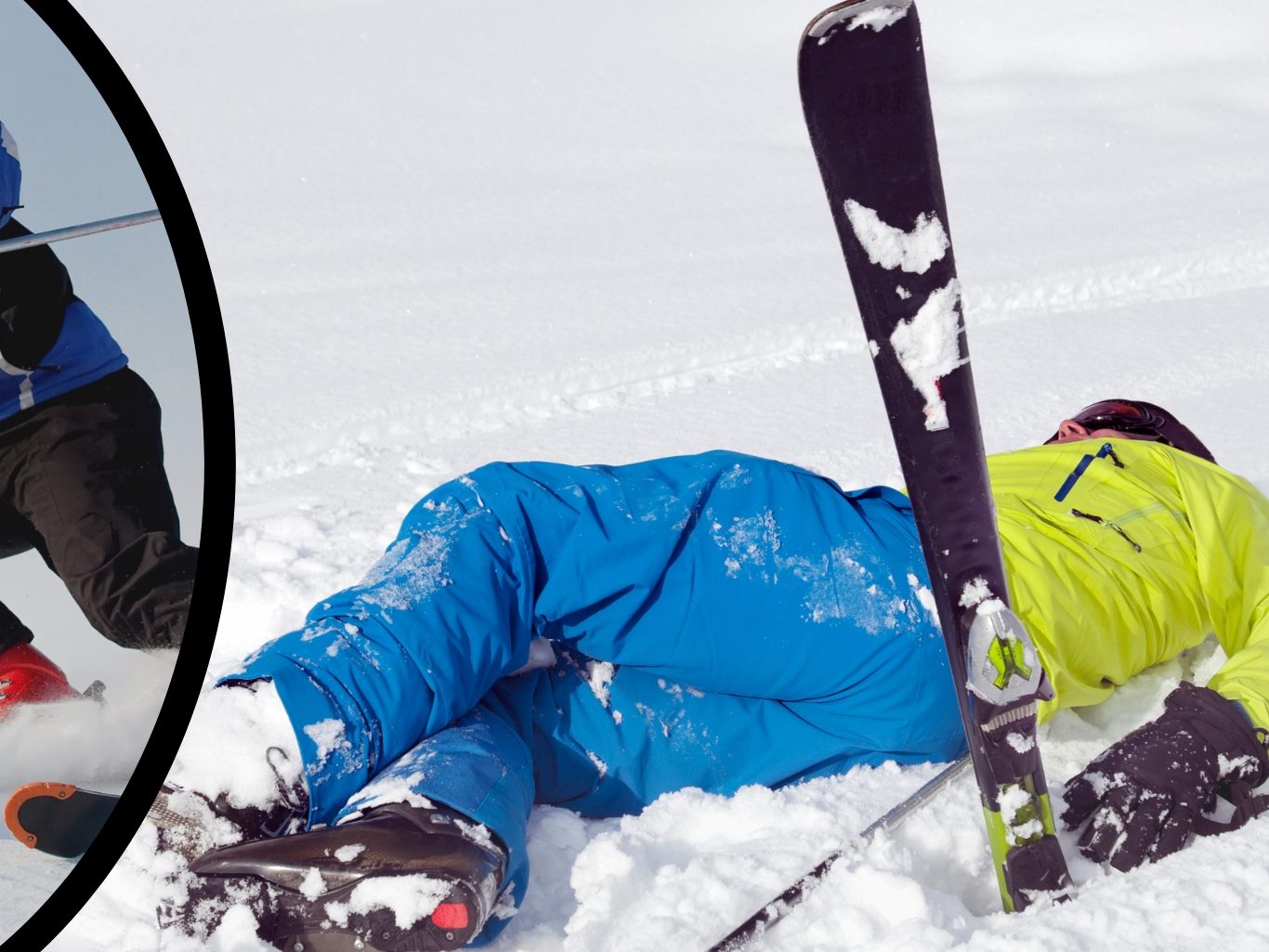 Schikollision am Saloberkopf – Zeugenaufruf