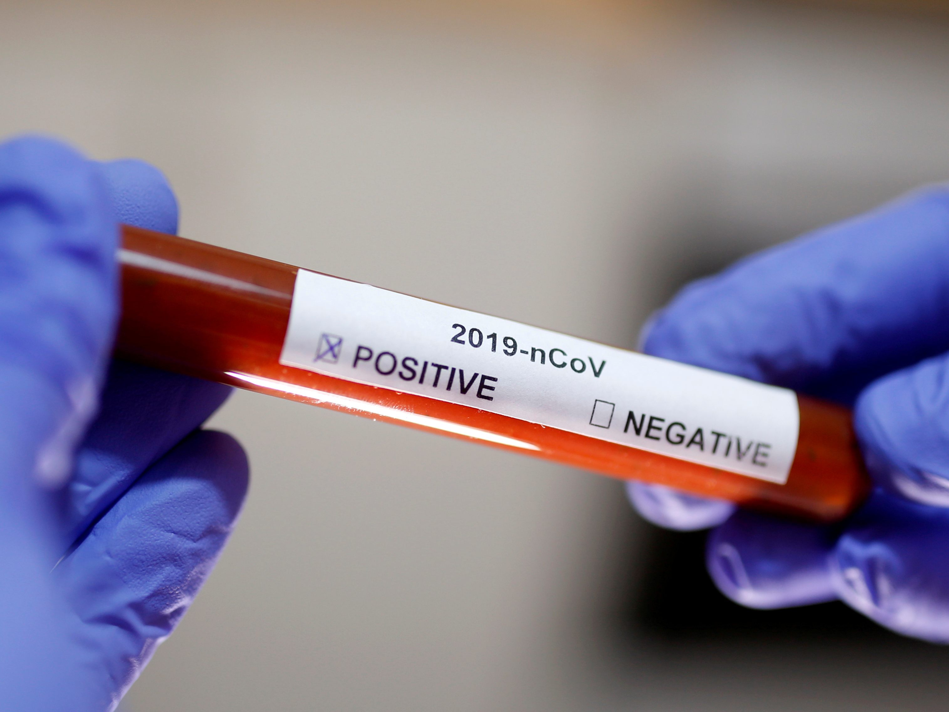 Virologen fanden keine neuen Corona-Varianten in China.