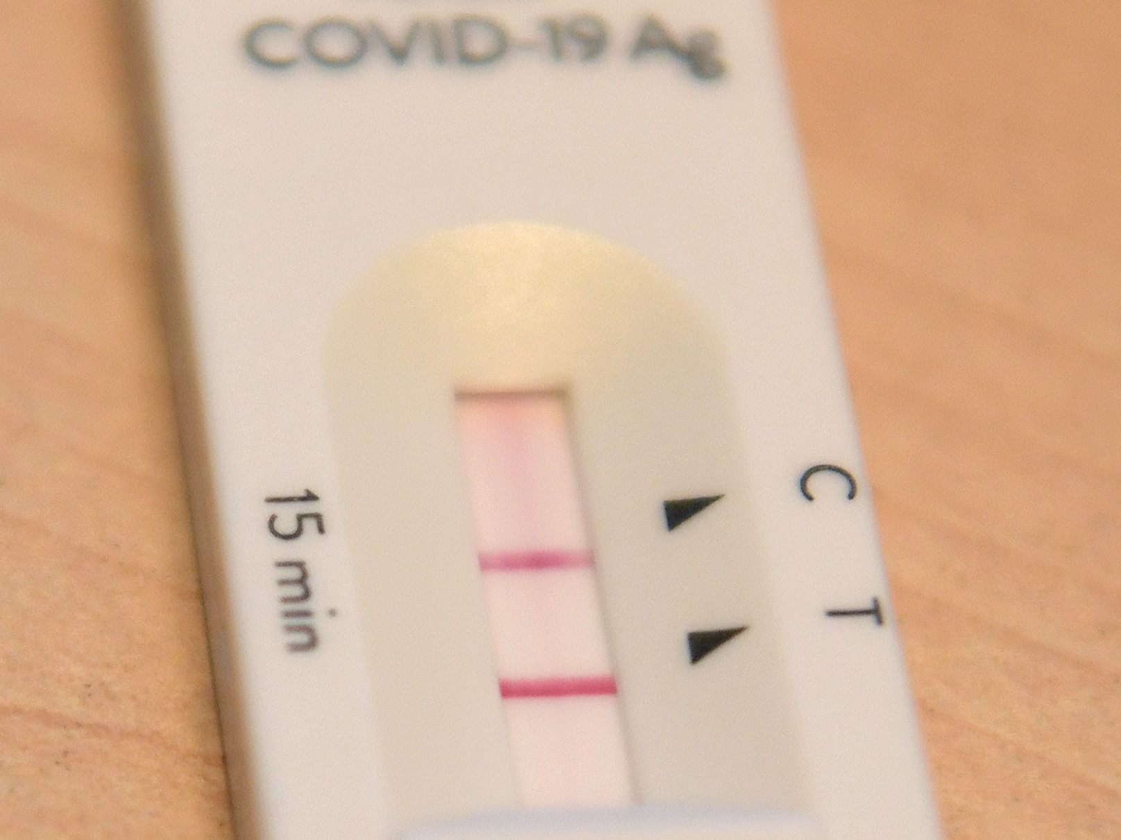 Es werden mehr Corona-Infektionen und -Patienten erwartet.
