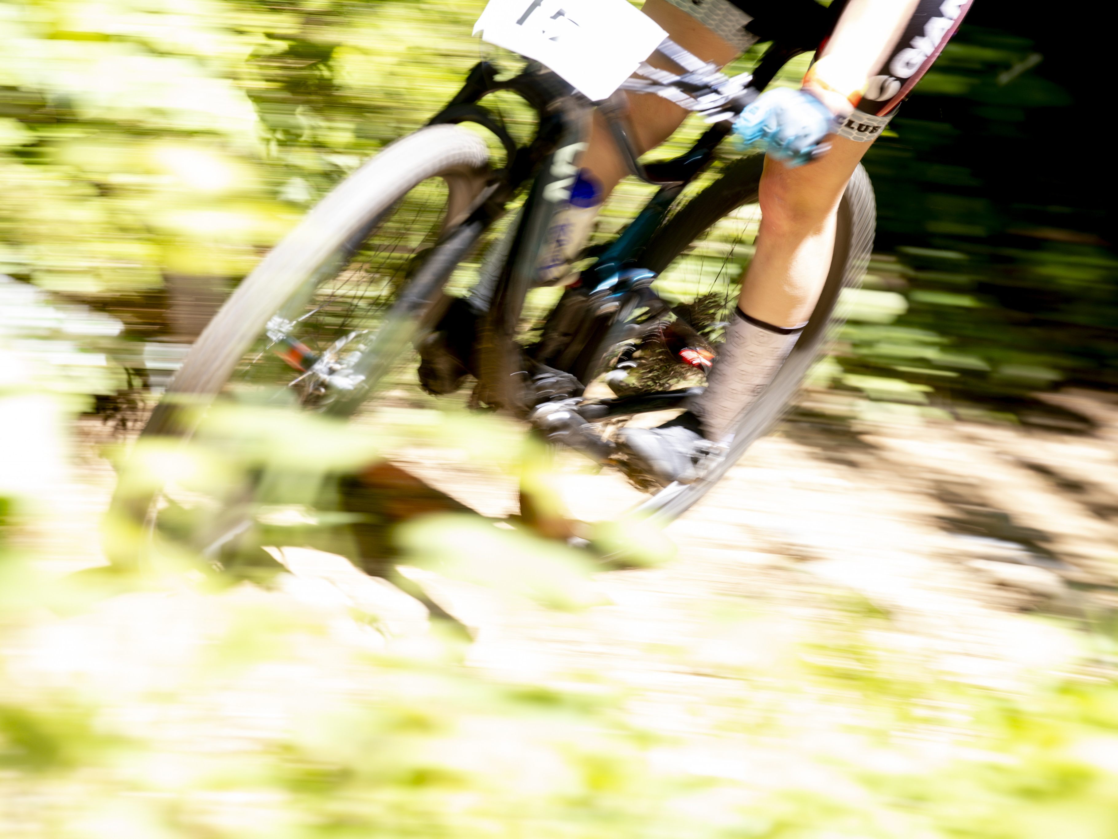 Im Vorjahr landetetn rund 5.900 verletzte Mountainbiker im Spital.