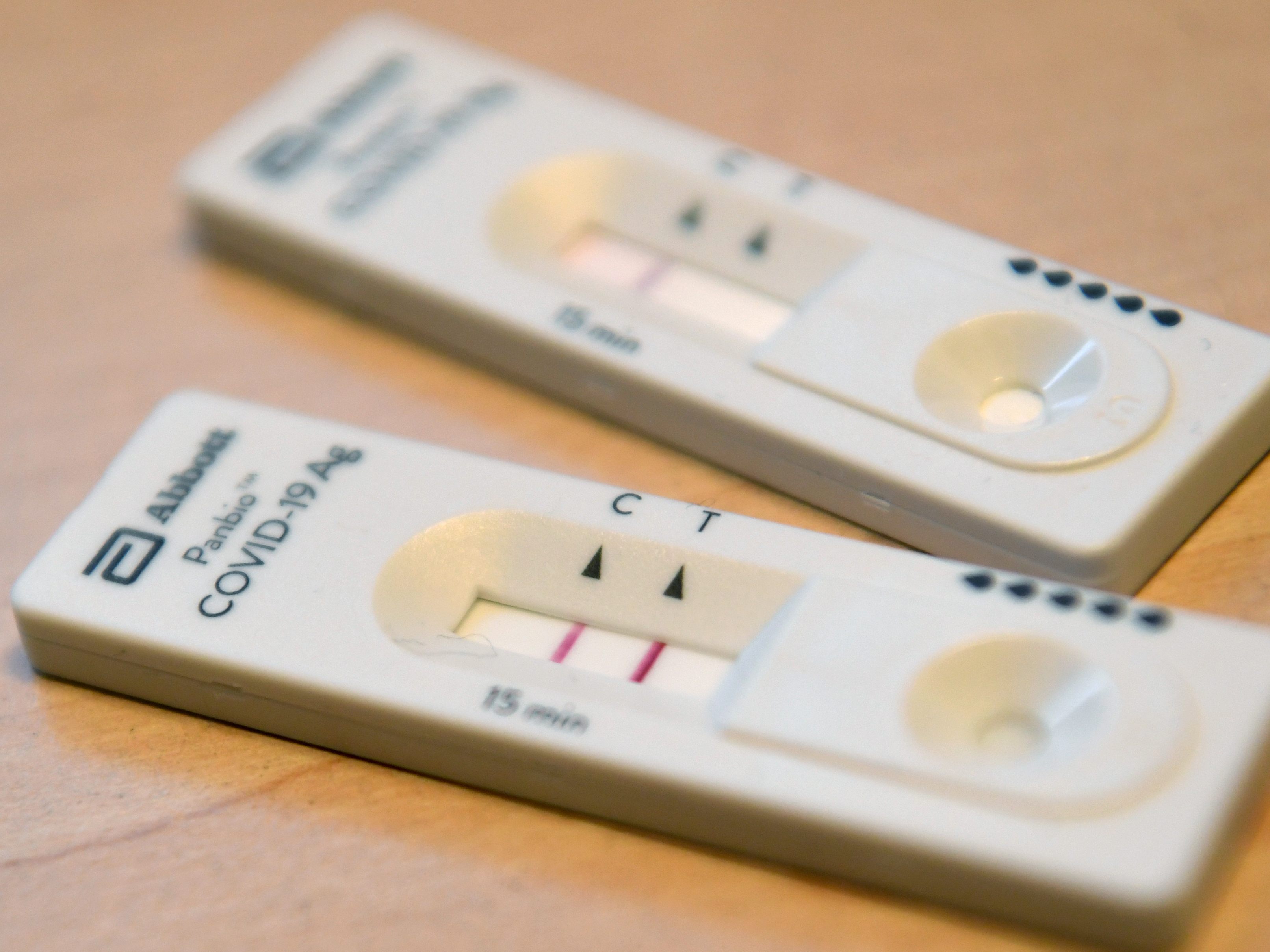 Kostenlose Corona-Tests bleiben für symptomatische Personen weiter möglich. Kostenlose Corona-Tests bleiben für symptomatische Personen weiter möglich.