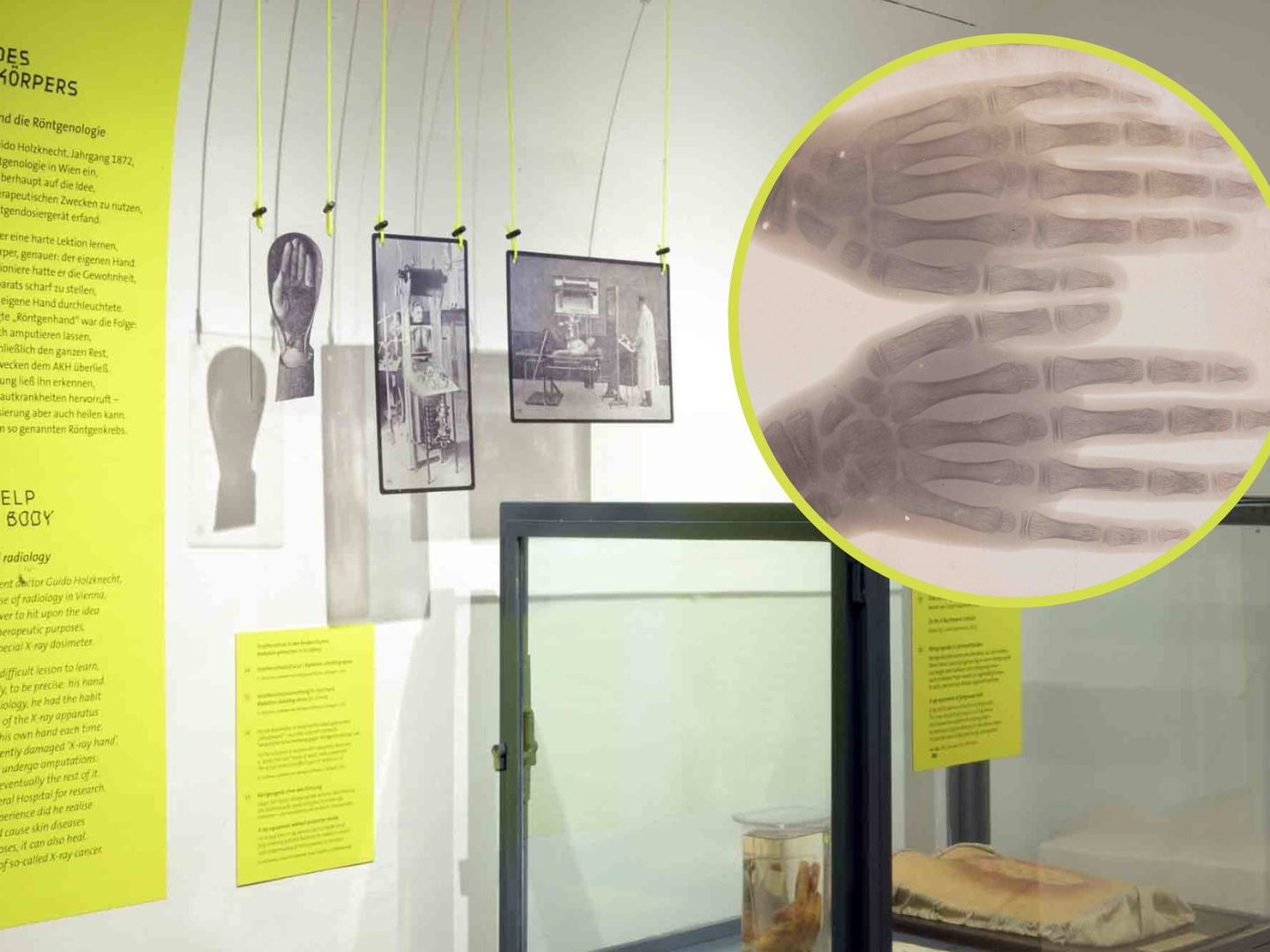 Eine Sonderausstellung im Narrenturm zeigt, wie Strahlen schaden. Eine Sonderausstellung im Narrenturm zeigt, wie Strahlen schaden.