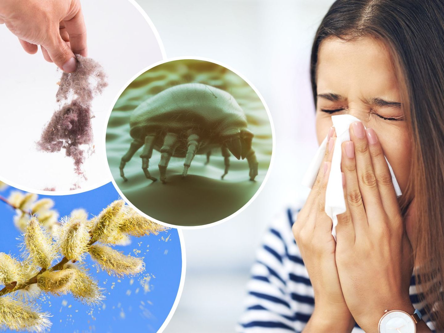 Jeder Sechste Österreicher wird von einer Allergie geplagt.
