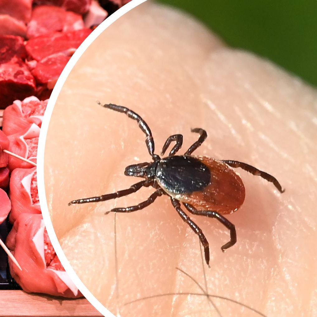 Fälle von Fleischallergie nach Zeckenstichen sind auch in Österreich bekannt.