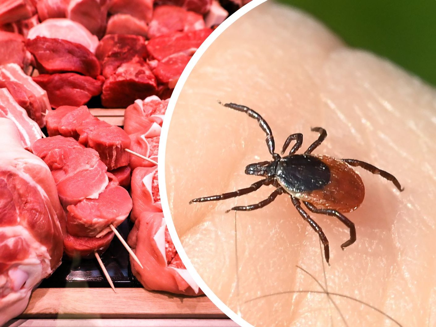Fälle von Fleischallergie nach Zeckenstichen sind auch in Österreich bekannt. Fälle von Fleischallergie nach Zeckenstichen sind auch in Österreich bekannt.