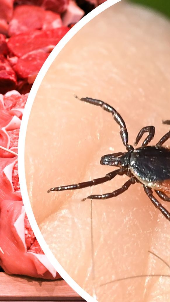 Fälle von Fleischallergie nach Zeckenstichen sind auch in Österreich bekannt.